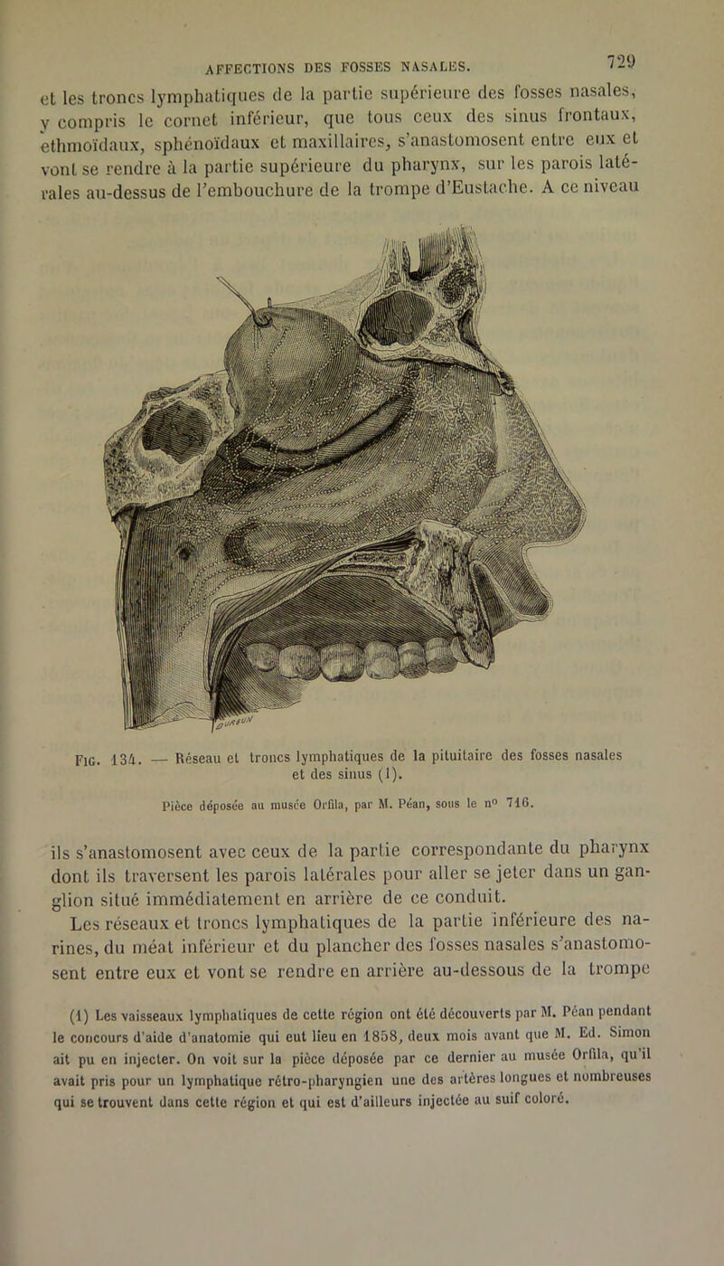 et les troncs lymphatiques de la partie supérieure des fosses nasales, V compris le cornet inférieur, que tous ceux des sinus frontaux, èthmoïdaux, sphénoïdaux et maxillaires, s’anastomosent entre eux et vont se rendre à la partie supérieure du pharynx, sur les parois laté- rales au-dessus de l’embouchure de la trompe d’Eustache. A ce niveau FiG. 134. Réseau et troncs lymphatiques de la pituitaire des fosses nasales et des sinus (1). Pièce déposée au musée Orfila, par M. Péan, sous le n“ 710. ils s’anastomosent avec ceux de la partie correspondante du pharynx dont ils traversent les parois latérales pour aller se jeter dans un gan- glion situé immédiatement en arrière de ce conduit. Les réseaux et troncs lymphatiques de la partie inférieure des na- rines, du méat inférieur et du plancher des fosses nasales s’anastomo- sent entre eux et vont se rendre en arrière au-dessous de la trompe (1) Les -vaisseaux lymphatiques de cette région ont été découverts par M. Péan pendant le concours d’aide d'anatomie qui eut lieu en 1858, deux mois avant que M. Ed. Simon ait pu en injecter. On voit sur la pièce déposée par ce dernier au musée Orfila, qu il avait pris pour un lymphatique rétro-pharyngien une des artères longues et nombreuses qui se trouvent dans cette région et qui est d’ailleurs injectée au suif coloré.