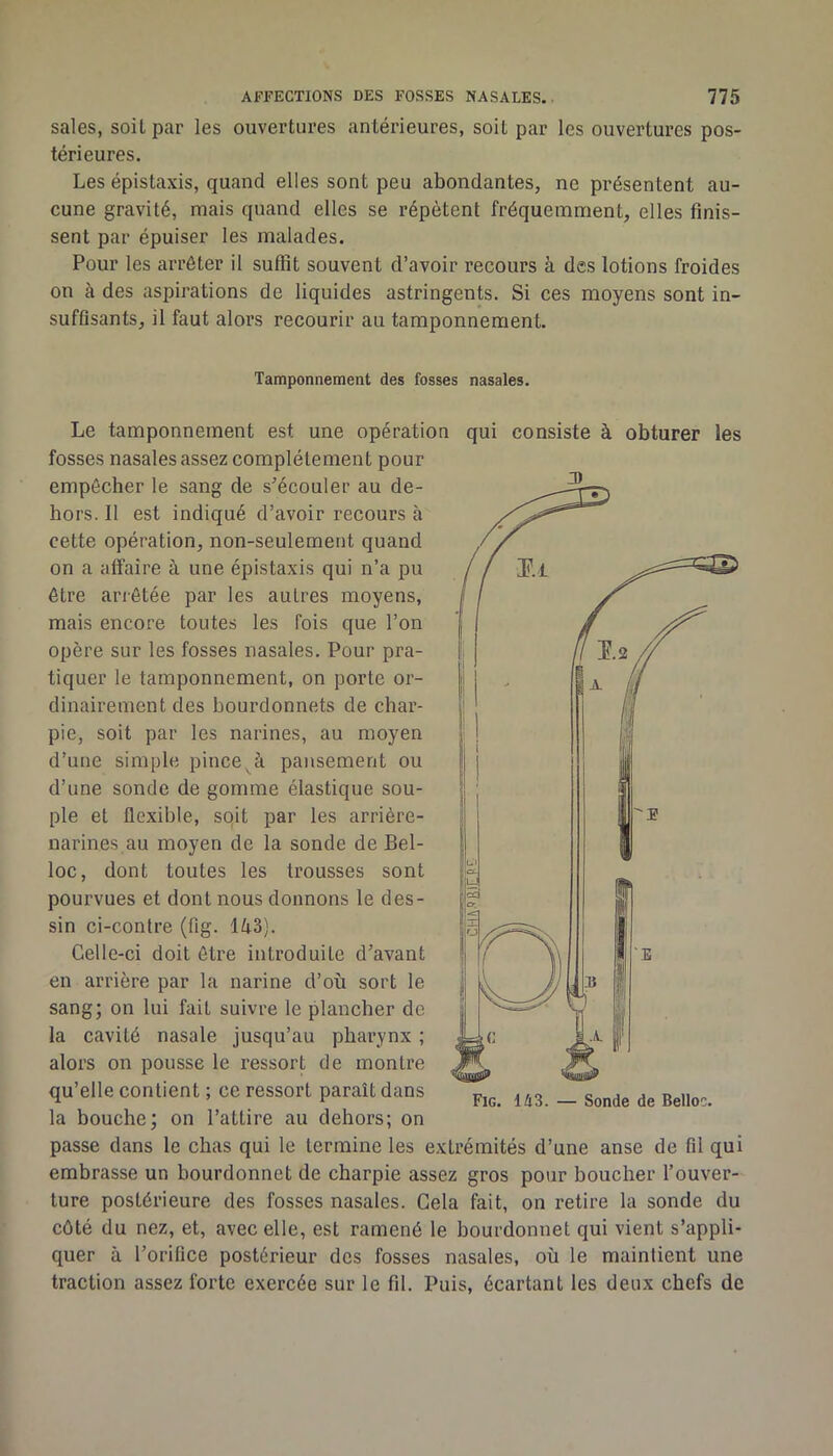 sales, soit par les ouvertures antérieures, soit par les ouvertures pos- térieures. Les épistaxis, quand elles sont peu abondantes, ne présentent au- cune gravité, mais quand elles se répètent fréquemment, elles finis- sent par épuiser les malades. Pour les arrêter il suffit souvent d’avoir recours à des lotions froides on à des aspirations de liquides astringents. Si ces moyens sont in- suffisants, il faut alors recourir au tamponnement. Tamponnement des fosses nasales. 3 Le tamponnement est une opération qui consiste à obturer les fosses nasales assez complètement pour empêcher le sang de s'écouler au de- hors. Il est indiqué d’avoir recours à cette opération, non-seulement quand on a affaire à une épistaxis qui n’a pu être ariêtée par les autres moyens, mais encore toutes les fois que l’on opère sur les fosses nasales. Pour pra- tiquer le tamponnement, on porte or- dinairement des bourdonnets de char- pie, soit par les narines, au moyen d’une simple pince^à pansement ou d’une sonde de gomme élastique sou- ple et flexible, sqit par les arrière- narines au moyen de la sonde de Bel- loc, dont toutes tes trousses sont pourvues et dont nous donnons le des- sin ci-contre (fig. Ik^]. Celle-ci doit être introduite d’avant en arrière par la narine d’où sort le sang; on lui fait suivre le plancher de la cavité nasale jusqu’au pharynx ; alors on pousse le ressort de montre qu’elle contient ; ce ressort paraît dans la bouche; on l’attire au dehors; on passe dans le chas qui le termine les extrémités d’une anse de fil qui embrasse un bourdonnet de charpie assez gros pour boucher l’ouver- ture postérieure des fosses nasales. Gela fait, on retire la sonde du côté du nez, et, avec elle, est ramené le bourdonnet qui vient s’appli- quer à l’orifice postérieur des fosses nasales, où le maintient une traction assez forte exercée sur le fil. Puis, écartant les deux chefs de