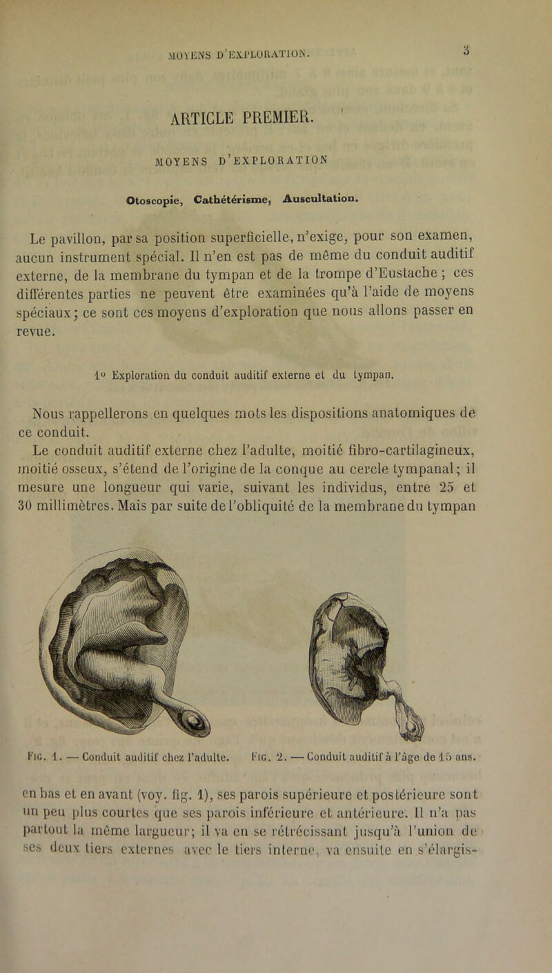MOUiNS û’iîXl’LURATlOiS. ARTICLE PREMIER. MOYENS d’exploration Otoscopie, Cathétérisme, Auscultation. Le pavillon, par sa position superficielle, n’exige, pour son examen, aucun instrument spécial. Il n’en est pas de môme du conduit auditif externe, de la membrane du tympan et de la trompe d’Eustache ; ces diüérentes parties ne peuvent être examinées qu’à l’aide de moyens spéciaux; ce sont ces moyens d’exploration que nous allons passer en revue. 1“ Exploration du conduit auditif externe et du tympan. Nous rappellerons en quelques mots les dispositions anatomiques de ce conduit. Le conduit auditif externe chez l’adulte, moitié fibro-cartilagineux, moitié osseux, s’étend de l’origine de la conque au cercle tympanal ; il mesure une longueur qui varie, suivant les individus, entre 25 et 30 millimètres. Mais par suite de l’obliquité de la membrane du tympan Fig. 1. — Conduit auditif chez l’adulte. Fig. 2. — Conduit auditif à l’àge de If) ans. en bas et en avant (voy. fig. 1), ses parois supérieure et postérieure sont un peu |)lus courtes que ses parois inférieure et antérieure. Il n’a pas partout la môme largucur; il va eu sc rétrécissant jusqu’à l’union de ses deux tiers externes avec le tiers interne, va ensuite en s’élargis-