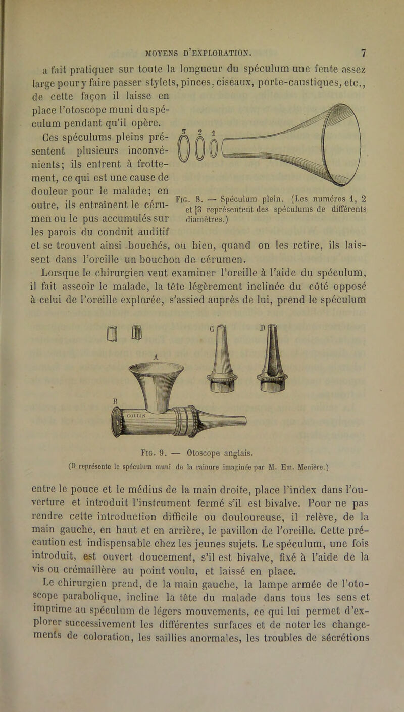 a fait pratiquer sur toute la longueur du spéculum une fente assez large poury faire passer stylets, pinces, ciseaux, porte-caustiques, etc., de cette façon il laisse en place l’otoscope muni du spé- culum pendant qu’il opère. Ces spéculums pleins pré- sentent plusieurs inconvé- nients; ils entrent à frotte- ment, ce qui est une cause de douleur pour le malade; en outre, ils entraînent le céru- men ou le pus accumulés sur les parois du conduit auditif et se trouvent ainsi bouchés, ou bien, quand on les retire, ils lais- sent dans l’oreille un bouchon de cérumen. Lorsque le chirurgien veut examiner l’oreille à l’aide du spéculum, il fait asseoir le malade, la tête légèrement inclinée du côté opposé à celui de l’oreille explorée, s’assied auprès de lui, prend le spéculum Fig. 8. — Spéculum plein. (Les numéros 1, 2 et [3 représentent des spéculums de différents diamètres.) Fig. 9. — Otoscope anglais. (D représente le spéculum muni de la rainure imaginée par M. Em. Mcnière.) entre le pouce et le médius de la main droite, place l’index dans l’ou- verture et introduit l’instrument fermé s’il est bivalve. Pour ne pas rendre cette introduction difficile ou douloureuse, il relève, de la main gauche, en haut et en arrière, le pavillon de l’oreille. Cette pré- caution est indispensable chez les jeunes sujets. Le spéculum, une fois introduit, est ouvert doucement, s’il est bivalve, fixé à l’aide de la vis ou crémaillère au point voulu, et laissé en place. Le chirurgien prend, de la main gauche, la lampe armée de l’oto- scope parabolique, incline la tête du malade dans tous les sens et imprime au spéculum de légers mouvements, ce qui lui permet d’ex- plorer successivement les difiérentes surfaces et de noter les change- ments de coloration, les saillies anormales, les troubles de sécrétions