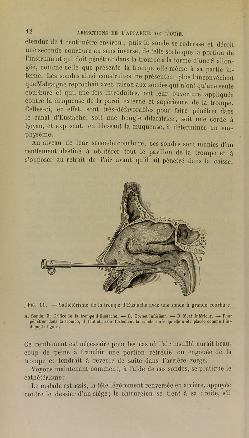 étendue de 1 centimètre environ ; puis la sonde se redresse et décrit une seconde courbure en sens inverse, de telle sorte que la portion de l’instrument qui doit pénétrer dans la trompe a la forme d’une S allon- gée, comme celle que présente la trompe elle-même à sa partie in- terne. Les sondes ainsi construites ne présentent plus l’inconvénient queMalgaigne reprochait avec raison aux sondes qui n’ont qu’une seule courbure et qui, une fois introduites, ont leur ouverture appliquée contre la muqueuse de la paroi externe et supérieure de la trompe. Celles-ci, en effet, sont très-défavorables pour faire pénétrer dans le canal d’Eustache, soit une bougie dilatatrice, soit une corde à Uoyau, et exposent, en blessant la muqueuse, à déterminer un em- physème. Au niveau de leur seconde courbure, ces sondes sont munies cLun renflement destiné à oblitérer tout le pavillon de la trompe et à s’opposer au retrait de l’air avant qu’il ait pénétré dans la caisse. , Fig. 11. — Calliétérisme rie la trompe tl’EusIaclie avec une sonde à grande courbure. A. Sonde. B. Orifice do la trompe d’Eustaclie. — C. Cornet inférieur. — D. Méat inférieur. — Pour pénétrer dans la trompe, il faut abaisser fortement la sonde après qu'elle a été placée comme l'in- dique la figure. Ce renflement est néçessaire pour les cas où l’air insufflé aurait beau- coup de peine à franchir une portion rétrécie ou engouée de la trompe et tendrait à revenir de suite dans l’arrière-gorge. Voyons maintenant comment, à l’aide de ces sondes, se pratique le cathétérisme : Le malade est assis, la tète légèrement renversée en arrière, appuyée contre le dossier d’un siège; le chirurgien se tient à sa droite, s’il