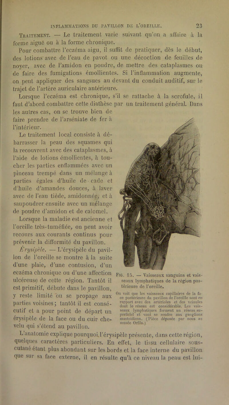 Traitement. — Le traitement varie suivant qu’on a alîaire à la forme aiguO ou à la forme chronique. Pour combattre l’eczéma aigu, il suffit de pratiquer, dès le début, des lotions avec de Peau de pavot ou une décoction de feuilles de noyer, avec de Pamidon en poudre, de mettre des cataplasmes ou de faire des fumigations émollientes. Si l’inflammation augmente, on peut appliquer des sangsues au devant du conduit auditif, sur le trajet de l’artère auriculaire antérieure. Lorsque l’eczéma est chronique, s’il se rattache à la scrofule, il faut d^abord combattre cette diathèse par un traitement général. Dans les autres cas, on se trouve bien de faire prendre de Parséniate de fer à l’intérieur. Le traitement local consiste dé- barrasser la peau des squames qui la recouvrent avec des cataplasmes, îi l’aide de lotions émollientes, à tou- cher les parties enflammées avec un pinceau trempé dans un mélange à parties égales d’huile de cade et d’huile d'amandes douces, à laver avec de Peau tiède, amidonnée, et à saupoudrer ensuite avec un mélange de poudre d’amidon et de calomel. Lorsque la maladie est ancienne et l’oreille très-tuméfiée, on peut avoir recours aux courants continus pour prévenir la difformité du pavillon. Erysipèle. — L’érysipèle du pavil- lon de l’oreille se montre à la suite d’une plaie, d'une contusion, d’un eczéma chronique ou d’une aüèction ulcéreuse de cette région. Tantôt il est primitif, débute dans le pavillon, y reste limité ou se propage aux parties voisines; tantôt il est consé- cutif et a pour point de départ un érysipèle de la face ou du cuir che- velu qui s’étend au pavillon. L’anatomie explique pourquoi.Pérysipèle présente, dans cette région, quelques caractères particuliers. En effet, le tissu cellulaire sous- cutané étant plus abondant sur les bords et la face interne du pavillon que sur sa face externe, il en résulte qu':\ ce niveau la peau est lui- Fig. 15. — Vaisseaux sanguins et vais- seaux lymphatiques de la région pos- térieure de l’oreille. Ou voit que les vaisseaux capillaires de la fa- ce postérieure du pavillon de l’oreille sont en rapport avec des artérioles et des veinules dont le réseau est considérable. Les vais- seaux lymplialiqucs forment un réseau su- perficiel et vont se rendre aux ganglions mastoïdiens. ( Pièce déposée par nous au musée Orfila.) '