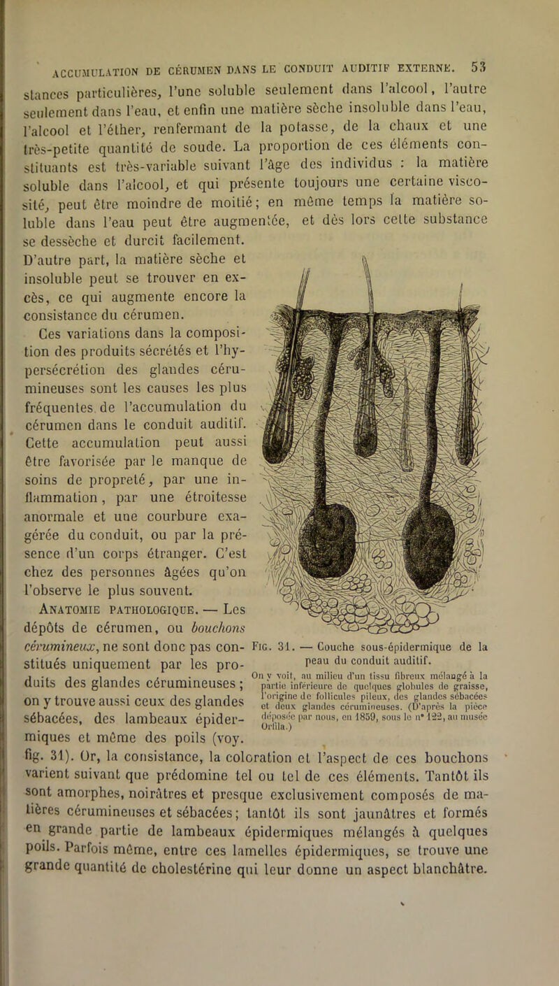 stances particulières, l’une soluble seulement clans l’alcool, l’autre seulement dans l’eau, et enfin une matière sèche insoluble dans l’eau, l’alcool et l’éther, renfermant de la potasse, de la chaux et une très-petite ejuantité de soude. La proportion de ces éléments con- stituants est très-variable suivant l’âge des individus ; la matière soluble dans l’alcool, et qui présente toujours une certaine visco- sité, peut être moindre de moitié; en môme temps la matière so- luble dans l’eau peut être augmentée, et dès lors cette substance se dessèche et durcit facilement. D’autre part, la matière sèche et insoluble peut se trouver en ex- cès, ce qui augmente encore la consistance du cérumen. Ces variations dans la composi- tion des produits sécrétés et l’hy- persécrétion des glandes céru- mineuses sont les causes les plus fréquentes de l’accumulation du cérumen dans le conduit auditif. Cette accumulation peut aussi être favorisée par le manque de soins de propreté, par une in- flammation , par une étroitesse anormale et une courbure exa- gérée du conduit, ou par la pré- sence d’un corps étranger. C’est chez des personnes âgées qu’on l’observe le plus souvent. Anatomie pathologique. — Les dépôts de cérumen, ou bouchons cérumineux^wa sont donc pas con- Fig. 31. — Couche sous-épidermique de la stitués uniquement par les pro- du conduit auditif. 1 J I I , . On V voit, nu milieu d’un tissu fibreux raélangé à la üuits des glandes cérummeuses ; partie inferieure do quelques globules de graisse, nn V trnnvp aussi ppiiv Hps frlnnrlps l’‘»’'g:>ne de follicules pileux, dos glandes sébacées un y trouve aussi ceux aes giannes J,t Joux ^lamles cérumineuses. (D’après la pièce sébacées, des lambeaux énider- déposée par nous, on tSSO, sous le u* 1-22, au musée * ürlila.) miques et môme des poils (voy. fig. 31). ür, la consistance, la coloration et l’aspect de ces bouchons varient suivant que prédomine tel ou tel de ces éléments. Tantôt ils sont amorphes, noirâtres et presque exclusivement composés de ma- tières cérumineuses et sébacées; tantôt ils sont jaunâtres et formés en grande partie de lambeaux épidermiques mélangés â quelques poils. Parfois môme, entre ces lamelles épidermiques, se trouve une grande quantité de cholestérine qui leur donne un aspect blanchâtre.