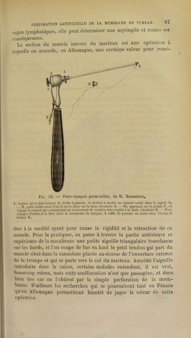 PERFORATION ARTIFICIELLE DE LA MEMBRANE DU TYMPAN. O/ sujets lymphatiques, elle peut déterminer une myringite et toutes ses eonséquences. La section du muscle interne du marteau est une opération à laquelle on accorde, en Allemagne, une certaine valeur pour remé- A, bouton qu’on doit tourner de droite à gauclic, et destiné à tendre un ressort caclié dans la cupule P, ’ H, porte-œillet muni d'un fil qu’on place sur la lame circulaire B. — En appuyant sur la pédale F, on ilégage le ressort qui communique un mouvement de rotation très-rapide à la lame circulaire B. — Pour ilégagcr l’œillet et le fixer dans la membrane du tympan, il suffit de pousser en avant avec l’index le bouton E. dier à la surdité ayant pour cause la rigidité et la rétraction de ce muscle. Pour la pratiquer, on passe à travers la partie antérieure et supérieure de la membrane une petite aiguille triangulaire tranchante sur les bords, et l’on coupe de bas en haut le petit tendon qui part du muscle situé dans la cannelure placée au-dessus de l’ouverture externe •de la trompe et qui se porte vers le col du marteau. Aussitôt Taiguille introduite dans la caisse, certains malades entendent, il est vrai, beaucoup mieux, mais cette amélioration n’est que passagère, et dans bien des cas on l’obtient par la simple perforation de la mem- brane. D’ailleurs les recherches qui se poursuivent tant en France qu’en Allemagne permettront bientôt de juger la valeur de celte opération.