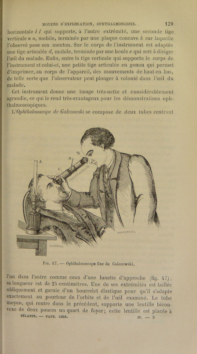 horizontale 11 qui supporte, à l’autre extrémité, une seconde tige verticale n «, mobile, terminée par une plaque concave k sur laquelle l’observé pose son menton. Sur le corps de l’instrument est adaptée une tige articulée d, mobile, terminée par une boule e qui sert à diriger l’œil du malade. Enfin, entre la tige verticale qui supporte le corps de l’instrument et celui-ci, une petite tige articulée en genou qui permet d’imprimer, au corps de l’appareil, des mouvements de haut en bas, de telle sorte que l’observateur peut plonger à volonté dans l’œil du malade. Cet instrument donne une image très-nette et considérablement agrandie, ce qui le rend très-avantageux pour les démonstrations oph- thalmoscopiques. UOphthalmoscope de Galezoïvski se compose de deux tubes rentrant Fig. 47. — Ophlhalmoscope fixe de Galezowski. l’un dans l’antre comme ceux d’une lunette d’approche (fig. è7) ; sa longueur est de 25 centimètres. Une de ses extrémités est taillée obliquement et garnie d’un bourrelet élastique pour qu’il s’adapte exactement au pourtour de l’orbite et de l’œil examiné. Le tube moyen, qui rentre dans le précédent, supporte une lentille bicon- vexe de deux pouces un quart de foyer; cette lentille est placée h NÉLATON. — PATn. CUIR. jy. «J