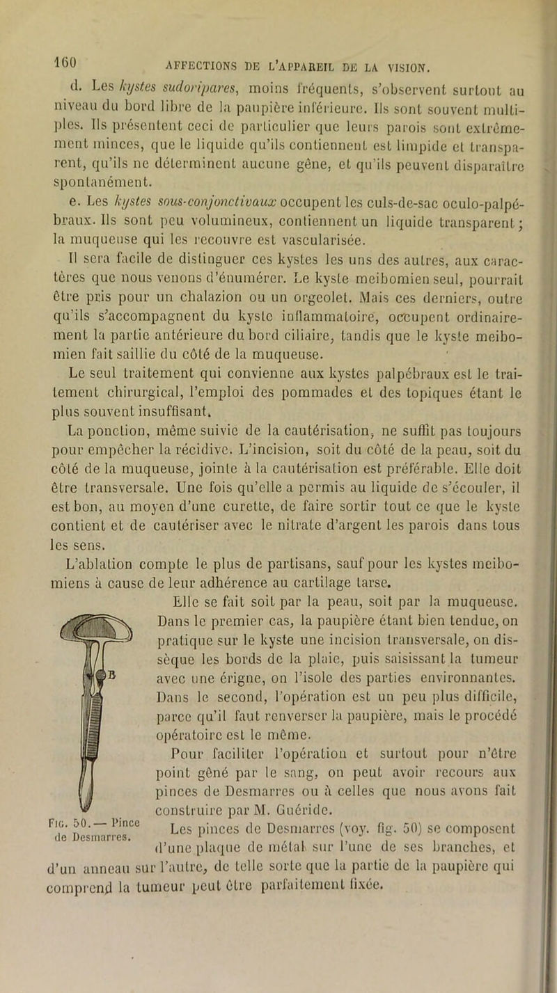 1(30 cl. Les kystes sudoripares, moins Iréquenls, s’observent surtout au niveau du bord libre de la paupière inrérieurc. Ils sont souvent niulti- ])les. Us présentent ceci de parliculier c]ue leurs parois sont exlrêrne- mcnt minces, que le liquide qu’ils contiennent est limpide et transpa- rent, qu’ils ne déterminent aucune gêne, et qu’ils peuvent disparaître spontanément. e. Les kystes sous-conjo7iciivaux occupent les culs-de-sac oculo-palpé- braux. Ils sont peu volumineux, contiennent un liquide transparent; la muqueuse qui les recouvre est vascularisée. Il sera facile de distinguer ces kystes les uns des autres, aux carac- tères que nous venons d’énumérer. Le kyste meibomien seul, pourrait être pris pour un chalazion ou un orgeolet. Mais ces derniers, outre qu’ils s’accompagnent du kyste inllammatoire, occupent ordinaire- ment la partie antérieure du bord ciliaire, tandis que le kyste meibo- mien fait saillie du côté de la muqueuse. Le seul traitement qui convienne aux kystes palpébraux est le trai- tement chirurgical, l’emploi des pommades et des topiques étant le plus souvent insuffisant. La ponction, même suivie de la cautérisation, ne suffit pas toujours pour empêcher la récidive. L’incision, soit du côté de la peau, soit du côté de la muqueuse, jointe à la cautérisation est préférable. Elle doit être transversale. Une fois qu’elle a permis au liquide de s’écouler, il est bon, au moyen d’une curette, de faire sortir tout ce que le kyste contient et de cautériser avec le nitrate d’argent les parois dans tous les sens. L’ablation compte le plus de partisans, sauf pour les kystes meibo- miens à cause de leur adhérence au cartilage tarse. Elle se fait soit par la peau, soit par la muqueuse. Dans le premier cas, la paupière étant bien tendue, on pratique sur le kyste une incision transversale, on dis- sèque les bords de la plaie, puis saisissant la tumeur avec une érigne, on l’isole des parties environnantes. Dans le second, l’opération est un peu plus difficile, parce qu’il faut renverser la paupière, mais le procédé opératoire est le môme. Pour faciliter l’opération et surtout pour n’étre point gêné par le sang, on peut avoir recours aux pinces de Desmarres ou ii celles que nous avons fait construire par M. Guéride. de Desniarres pinces dc Desmarrcs (voy. fig. 50) se composent d’une plaque dc métal sur l’une dc ses branches, cl d’un anneau sur l’autre, de telle sorte que la partie de la paupière qui comprend la tumeur peut être parlaitcmcnl fixée.
