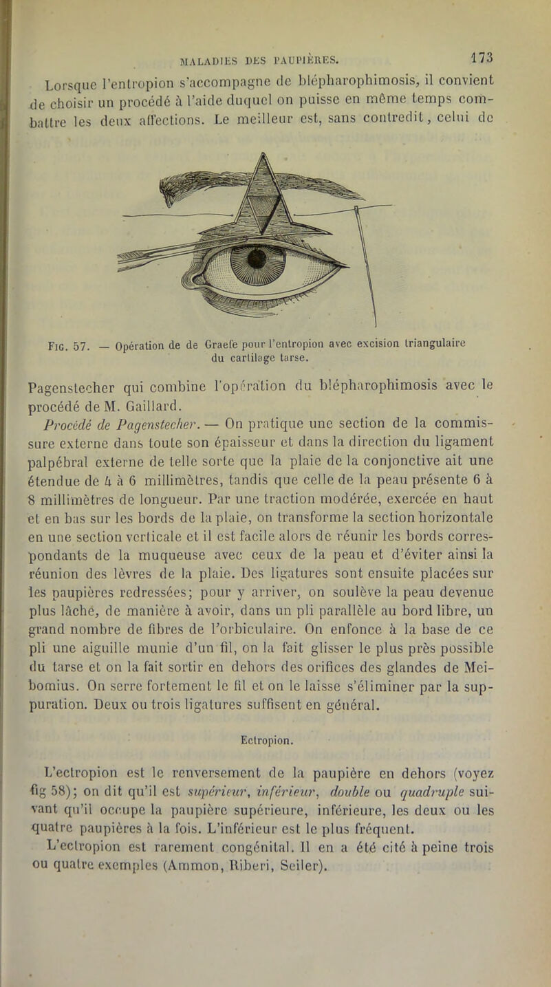 Lorsque l’enlropion s’accompagne de blépharophimosis, il convient de choisir un procédé h l’aide duquel on puisse en môme temps com- battre les deux atléctions. Le meilleur est, sans contredit, celui de Fig. 57. — Opération de de Graefe pour l’enlropioii avec excision triangulaire du cartilage tarse. Pagenslecher qui combine l’oppralion du blépharophimosis avec le procédé de M. Gaillard. Procédé de Pagenslecher. — On pratique une section de la commis- sure externe dans toute son épaisseur et dans la direction du ligament palpébral externe de telle sorte que la plaie de la conjonctive ait une étendue de Zt à 6 millimètres, tandis que celle de la peau présente 6 à 8 millimètres de longueur. Par une traction modérée, exercée en haut et en bas sur les bords de la plaie, on transforme la section horizontale en une section verticale et il est facile alors de réunir les bords corres- pondants de la muqueuse avec ceux de la peau et d’éviter ainsi la réunion des lèvres de la plaie. Des ligatures sont ensuite placées sur les paupières redressées; pour y arriver, on soulève la peau devenue plus lâché, de manière à avoir, dans un pli parallèle au bord libre, un grand nombre de fibres de Porbiculaire. On enfonce à la base de ce pli une aiguille munie d’un fil, on la fait glisser le plus près possible du tarse et on la fait sortir en dehors des orifices des glandes de Mei- bomius. On serre fortement le fil et on le laisse s’éliminer par la sup- puration. Deux ou trois ligatures suffisent en général. Eclropion. L’eclropion est le renversement de la paupière en dehors (voyez fig 58); on dit qu’il est supérieur, inférieur, double ou quadruple sui- vant qu’il occupe la paupière supérieure, inférieure, les deux ou les quatre paupières à la fois. L’inférieur est le plus fréquent. L’ectropion est rarement congénital. 11 en a été cité à peine trois ou quatre exemples (Ammon, lliberi, Seller).