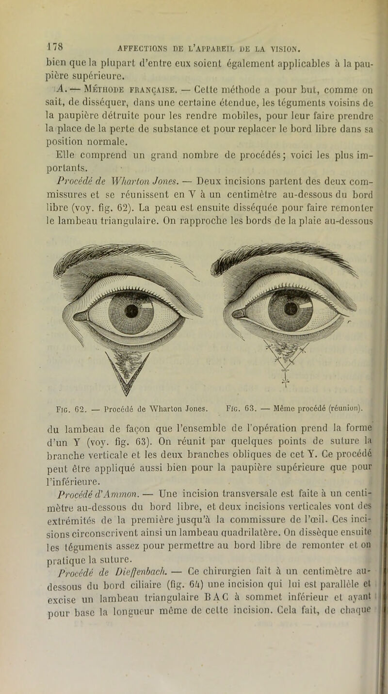 bien que la plupart d’entre eux soient également applicables à la pau- pière supérieure. A. — Méthode française. — Cette méthode a pour but, comme on sait, de disséquer, dans une certaine étendue, les téguments voisins de la paupière détruite pour les rendre mobiles, pour leur faire prendre la place de la perte de substance et pour replacer le bord libre dans sa position normale. Elle eomprend un grand nombre de procédés; voici les plus im- portants. Procédé de Wharlon Jones. — Deux incisions partent des deux com- missures et se réunissent en V à un centimètre au-dessous du bord libre (voy. fig. 62). La peau est ensuite disséquée pour faire remonter le lambeau triangulaire. On rapproche les bords de la plaie au-dessous Fig. 62. — Procédé de Wharlon Jones. Fig. 63. — Même procédé (réunion). du lambeau de façon que l’ensemble de l’opération prend la forme j d’un y (voy. fig. 63). On réunit par quelques points de suture la | branche verticale et les deux branches obliques de cet Y. Ce procédé j peut être appliqué aussi bien pour la paupière supérieure que pour | l’inférieure. I Procédé d'Ammon. — Une incision transversale est faite à un centi- mètre au-dessous du bord libre, et deux incisions verticales vont des (■ extrémités de la première jusqu’à la commissure de l’œil. Ces inci- îi sions circonscrivent ainsi un lambeau cfuadrilatère. On dissèque ensuite |‘ les téguments assez pour permettre au bord libre de remonter et on pratique la suture. ‘ Pî'océdé de Diefjenbach. — Ce chirurgien fait à un centimètre au- i ' dessous du bord ciliaire (fig. 6à) une incision qui lui est parallèle et I excise un lambeau triangulaire BAC à sommet inférieur et ayant | pour base la longueur môme de cette incision. Cela fait, de chaque i