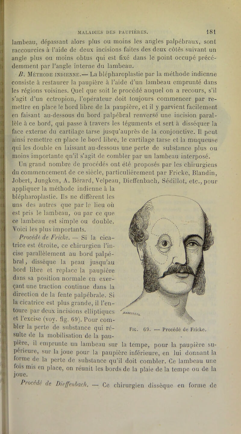 I lambeau, dépassant alors plus ou moins les angles palpébraux, sont 1 raccourcies à l’aide de deux incisions faites des deux côtés suivant un I) angle plus ou moins obtus qui est fixe dans le point occupé précc- demment par l’angle interne du lambeau. . B. Méthode indienne.— La blépharoplastie par la méthode indienne i consiste il restaurer la paupière à Laide d’un lambeau emprunté dans ) les régions voisines. Quel que soit le procédé auquel on a recours, s’il > s’agit d’un ectropion, l’opérateur doit toujours commencer par re- r mettre en place le bord libre de la paupière, et il y parvient facilement en faisant au-dessous du bord palpébral renversé une incision parai- ) lèle à ce bord, qui passe à travers les téguments et sert tà disséquer la ;; face externe du cartilage tarse jusqu’auprès de la conjonctive. Il peut ,1 ainsi remettre en place le bord libre, le cartilage tarse et la muqueuse ij qui les double en laissant au-dessous une perte de substance plus ou a moins importante qn’il s’agit de combler par un lambeau interposé. Un grand nombre de procédés ont été proposés par les chirurgiens (! du commencement de ce siècle, particulièrement par Fricke, Blandin, Jobert, Jungken, A. Bérarcl, Velpeau, Dieffenbach, Sédillot, etc., pour appliquer la méthode indienne ù la ■ trice est étroite, ce chirurgien l’in- ■ï cise parallèlement au bord palpé- bral, dissèque la peau jusqu’au bord libre et replace la paupière dans sa position normale en exer- çant une traction continue dans la direction de la fente palpébrale. Si la cicatrice est plus grande, il l’en- toure par deux incisions elliptiques et l’excise (voy. fig. 69). Pour com- . bltl la pei te de sidjstance qui ré- Eig. C9. — Procédé de Fricke. suite de la mobilisation de la pau- pière, il emprunte un lambeau sur la tempe, pour la paupière su- périeure, sur la joue pour la paupière inférieure, en lui donnant la forme de la perte de substance qu’il doit combler. Ce lambeau une fois mis en place, on réunit les bords de la plaie de la tempe ou de la joue. ! tùcéde de Dieffenhach, — Ce chirurgien dissèque eu forme de ijl blépharoplastie. Ils ne diffèrent les il uns des autres que par le lieu où ■- est pris le lambeau, ou par ce que a ce lambeau est simple ou double. Voici les plus importants. Procédé de Fricke. — Si la cica-