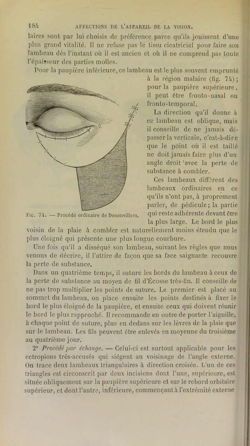 laires sont par lui choisis de préférence parce qu’ils jouissent d’une plus grand vitalité. Il ne refuse pas le tissu cicatriciel pour faire son lambeau dès l’instant où il est ancien et où il ne comprend pas toute l’épaisseur des parties molles. Pour la paupière inférieure, ce lambeau est le plus souvent emprunté à la région malaire (tîg. Vt); pour la paupière supérieure, il peut être fronto-nasal ou fronto-temporal. La direction qu’il donne à ce lambeau est oblique, mais il conseille de ne jamais dé- passer la verticale, c’est-à-dire que le point où il est taillé ne doit jamais faire plus d’un angle droit'avec la perte de substance à combler. Ces lambeaux diffèrent des lambeaux ordinaires en ce qu’ils n’ont pas, à proprement parler, de pédicule; la partie qui reste adhérente devant être la plus large. Le bord le plus voisin de la plaie à combler est naturellement moins étendu que le plus éloigné qui présente une plus longue courbure. Une fois qu’il a disséqué son lambeau, suivant les règles que nous venons de décrire, il l’attire de façon que sa face saignante recouvre la perte de substance. Dans un quatrième temps, il suture les bords du lambeau à ceux de la perte de substance au moyen de fil d’Écosse très-lin. 11 conseille de ne pas trop multiplier les points de suture. Le premier est placé au sommet du lambeau, on place ensuite les points destinés à fixer le bord le plus éloigné de la paupière, et ensuite ceux qui doivent réunir le bord le plus rapproché. Il recommande en outre de porter l’aiguille, à chaque point de suture, plus en dedans sur les lèvres de la plaie que sur le lambeau. Les fils peuvent être enlevés en moyenne du troisième au quatrième jour. 2“ Procédé par échange. — Celui-ci est surtout applicable pour les ectropions très-accusés qui siègent au voisinage de l’angle externe. On trace deux lambeaux triangulaires à direction croisée. L’un de ces triangles est circonscrit par deux incisions dont l’une, supérieure, est située obliquement sur la paupière supérieure et sur le rebord orbitaire supérieur, et dont l’autre, inférieure, commençant à l’extrémité externe