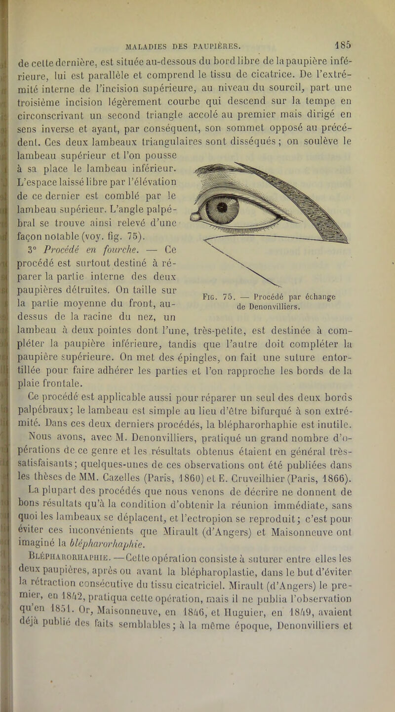 il »ï a '1 P ) i I ( t t * '.a I i ■Il li i li ■î « ' « ! 8! l H i 'I li ’■( I ■i I I 185 de celle dernière, est située au-dessous du bord libre de la paupière infé- rieure, lui est parallèle et comprend le tissu de cicatrice. De l’e.\tré- milé interne de l’incision supérieure, au niveau du sourcil, part une troisième incision légèrement courbe qui descend sur la tempe en circonscrivant un second triangle accolé au premier mais dirigé en sens inverse et ayant, par conséquent, son sommet opposé au précé- dent. Ces deux lambeaux triangulaires sont disséqués ; on soulève le lambeau supérieur et l’on pousse à sa place le lambeau inférieur. L’espace laissé libre par l’élévation de ce dernier est comblé par le lambeau supérieur. L’angle palpé- bral se trouve ainsi relevé d’une façon notable (voy. fig. 75). 3® Procédé en fourche. — Ce procédé est surtout destiné à ré- parer la partie interne des deux paupières détruites. On taille sur la partie moyenne du front, au- dessus de la racine du nez, un lambeau à deux pointes dont l’une, très-petite, est destinée à com- pléter la paupière inférieure, tandis que l’autre doit compléter la paupière supérieure. On met des épingles, on fait une suture entor- tillée pour faire adhérer les parties et l’on rapproche les bords de la plaie frontale. Ce procédé est applicable aussi pour réparer un seul des deux bords palpébraux; le lambeau est simple au lieu d’ûtre bifurqué à son extré- mité. Dans ces deux derniers procédés, la blépharorhaphie est inutile. Nous avons, avec M. Denonvilliers, pratiqué un grand nombre d’o- pérations de ce genre et les résultats obtenus étaient en général très- satisfaisants; quelques-unes de ces observations ont été publiées dans les thèses de MM. Gazelles (Paris, 1860) et E. Cruveilhier (Paris, 1866). La plupart des procédés que nous venons de décrire ne donnent de bons résultats qu’à la condition d’obtenir la réunion immédiate, sans quoi les lambeaux se déplacent, et l’ectropion se reproduit; c’est pour éviter ces inconvénients que Mirault (d’Angers) et Maisonneuve ont imaginé la blépharorhaphie. Blépiiauoriiaimiie.—Cette opération consiste à suturer entre elles les deux paupières, ajirès ou avant la blépharoplastie, dans le but d’éviter la rétraction consécutive du tissu cicatriciel. Mirault (d’Angers) le pre- mier, en 18/i2, pratiqua celte opération, mais il ne publia l’observation qu en 1851. Or, Maisonneuve, en I8à6, et Iluguier, en 18à9, avaient déjà publié des faits semblables; à la môme époque, Denonvilliers et Fig. 75. —■ Procédé par échange de Denonvilliers.