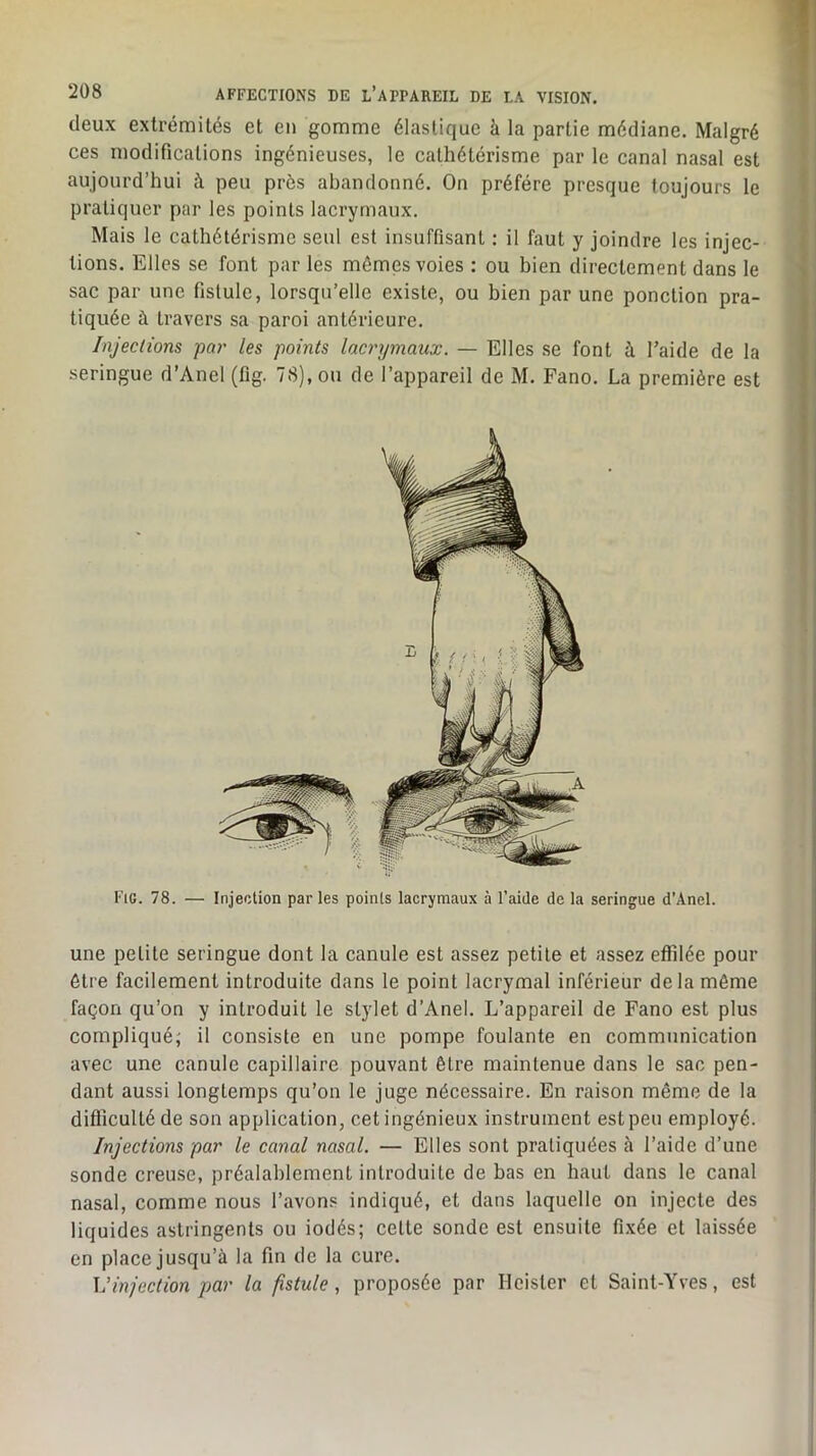 deux extrémités et en gomme élastique à la partie médiane. Malgré ces modifications ingénieuses, le cathétérisme par le canal nasal est aujourd’hui à peu près abandonné. On préféré presque toujours le pratiquer par les points lacrymaux. Mais le cathétérisme seul est insuffisant : il faut y joindre les injec- tions. Elles se font par les mômes voies : ou bien directement dans le sac par une fistule, lorsqu’elle existe, ou bien par une ponction pra- tiquée à travers sa paroi antérieure. Injections par les points lacnjmaux. — Elles se font à Taide de la seringue d’Anel (fig. 78), ou de l’appareil de M. Fano. La première est une petite seringue dont la canule est assez petite et assez effilée pour être facilement introduite dans le point lacrymal inférieur delà môme façon qu’on y introduit le stylet d’Anel. L’appareil de Fano est plus compliqué; il consiste en une pompe foulante en communication avec une canule capillaire pouvant être maintenue dans le sac pen- dant aussi longtemps qu’on le juge nécessaire. En raison même de la difficulté de son application, cet ingénieux instrument estpeu employé. Injections par le canal nasal. — Elles sont pratiquées à l’aide d’une sonde creuse, préalablement introduite de bas en haut dans le canal nasal, comme nous l’avons indiqué, et dans laquelle on injecte des liquides astringents ou iodés; celte sonde est ensuite fixée et laissée en place jusqu’à la fin de la cure. Vinjection par la fistule, proposée par Heister et Saint-Yves, est