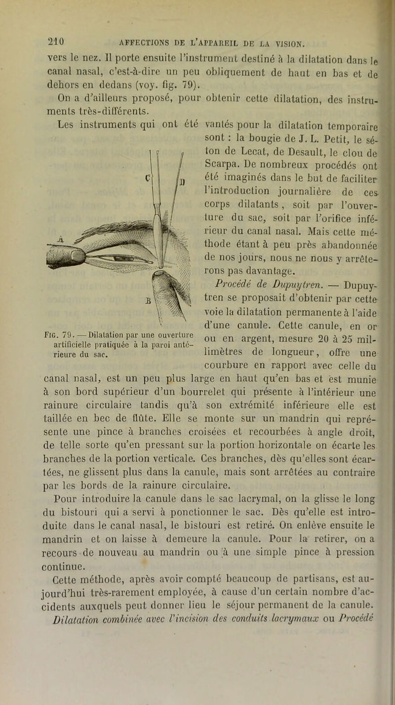 vers le nez. II porte ensuite rinstrument destiné à la dilatation dans le canal nasal, c’est-à-dire un peu obliquement de haut en bas et de dehors en dedans (voy. fig. 79). On a d’ailleurs proposé, pour obtenir cette dilatation, des instru- ments très-diirérents. Les instruments qui ont été Fig. 79. —Dilatation par une ouverture artificielle pratiquée à la paroi anté- rieure du sac. vantés pour la dilatation temporaire sont : la bougie de J. L. Petit, le sé- ton de Lecat, de Desault, le clou de Scarpa. De nombreux procédés ont été imaginés dans le but de faciliter l’introduction journalière de ces- corps dilatants, soit par l’ouver- ture du sac, soit par l’orifice infé- rieur du canal nasal. Mais cette mé- thode étant à peu près abandonnée de nos jours, nous ne nous y arrête- rons pas davantage. Procédé de Dupuytren. — Dupuy- tren se proposait d’obtenir par cette- voie la dilatation permanente à l’aide d’une canule. Cette canule, en or ou en argent, mesure 20 à 25 mil- limètres de longueur, offre une courbure en rapport avec celle du canal nasal, est un peu plus large en haut qu’en bas et est munie à son bord supérieur d’un bourrelet qui présente à l’intérieur une rainure circulaire tandis qu’à son extrémité inférieure elle est taillée en bec de flûte. Elle se monte sur un mandrin qui repré- sente une pince à branches croisées et recourbées à angle droit, de telle sorte qu’en pressant sur la portion horizontale on écarte les branches de la portion verticale. Ces branches, dès qu’elles sont écar- tées, ne glissent plus dans la canule, mais sont arrêtées au contraire par les bords de la rainure circulaire. Pour introduire la canule dans le sac lacrymal, on la glisse le long du bistouri qui a servi à ponctionner le sac. Dès qu’elle est intro- duite dans le canal nasal, le bistouri est retiré. On enlève ensuite le mandrin et on laisse à demeure la canule. Pour la retirer, on a recours de nouveau au mandrin ou à une simple pince à pression continue. Cette méthode, après avoir compté beaucoup de partisans, est au- jourd’hui très-rarement employée, à cause d’un certain nombre d’ac- cidents auxquels peut donner lieu le séjour permanent de la canule. Dilatation combinée avec l'incision des conduits lacrymaux ou Procédé