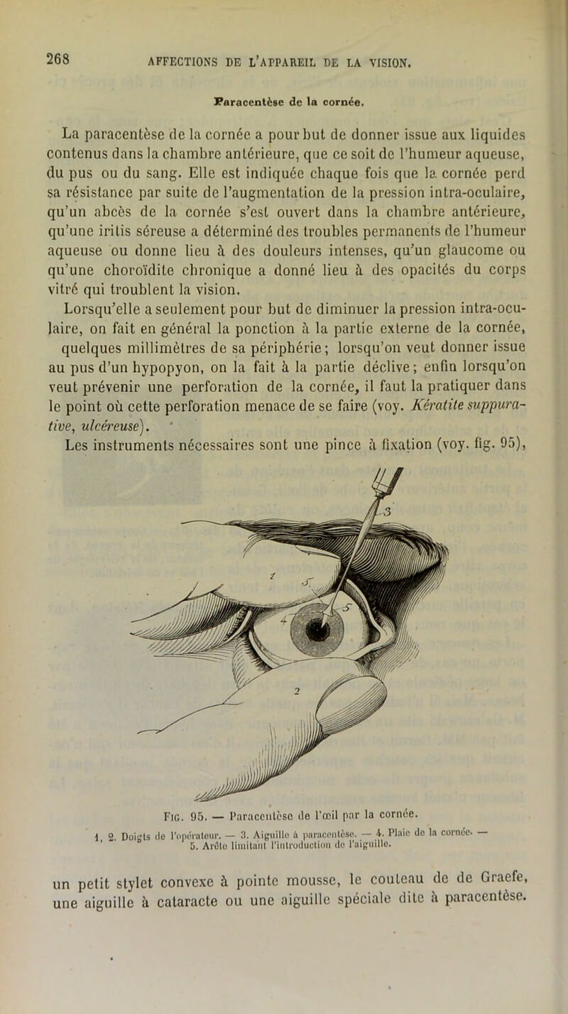 Paracentèse de la cornée. La paracentèse de la cornée a pour but de donner issue aux liquides contenus dans la chambre antérieure, que ce soit de l’humeur aqueuse, du pus ou du sang. Elle est indiquée chaque fois que la cornée perd sa résistance par suite de l’augmentation de la pression intra-oculaire, qu’un abcès de la cornée s’est ouvert dans la chambre antérieure, qu’une irilis séreuse a déterminé des troubles permanents de l’humeur aqueuse ou donne lieu à des douleurs intenses, qu’un glaucome ou qu’une choroïdite chronique a donné lieu à des opacités du corps vitré qui troublent la vision. Lorsqu’elle a seulement pour but de diminuer la pression intra-ocu- laire, on fait en général la ponction à la partie externe de la cornée, quelques millimètres de sa périphérie; lorsqu’on veut donner issue au pus d’un hypopyon, on la fait à la partie déclive ; enfin lorsqu’on veut prévenir une perforation de la cornée, il faut la pratiquer dans le point où cette perforation menace de se faire (voy. Kératite suppura- tive, ulcéreuse). Les instruments nécessaires sont une pince h fixation (voy. fig. 95), Fig. 95. — Paracciilcsc île l’œil par la cornée. i 2. Doiirts lie l’npL'i'ateur. — 3. Aiguille ù paracenlèse. — 4. Plaie do la cornée. 5. Arête limitant l’introduction de l'aiguille. un petit stylet convexe à pointe mousse, le couteau de de Graefe, une aiguille à cataracte ou une aiguille spéciale dite à paracentèse.
