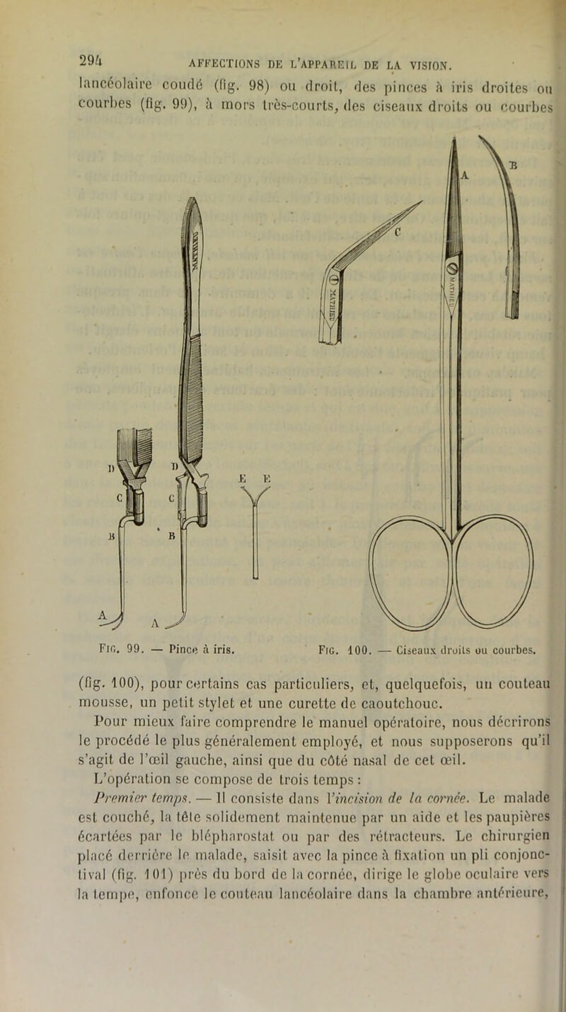 lanccolaii'e coudé (fig. 98) ou droit, des pinces à iris droites ou courbes (fig. 99), ii mors très-courts, des ciseaux droits ou courbes (fig. 100), pour certains cas particuliers, et, quelquefois, un couteau mousse, un petit stylet et une curette de caoutchouc. Pour mieux faire comprendre le manuel opératoire, nous décrirons le procédé le plus généralement employé, et nous supposerons qu’il s’agit de l’œil gauche, ainsi que du côté nasal de cet œil. L’opération se compose de trois temps : Premier temps. — Il consiste dans Vincision de la cornée. Le malade est couché, la tête solidement maintenue par un aide et les paupières écartées par le hlépharoslat ou par des rétracteurs. Le chirurgien placé derrière le malade, saisit avec la pince i\ fixation un pli conjonc- tival (fig. 101) i)rès du bord de la cornée, dirige le globe oculaire vers la tempe, enfonce le couteau lancéolaire dans la chambre antérieure,