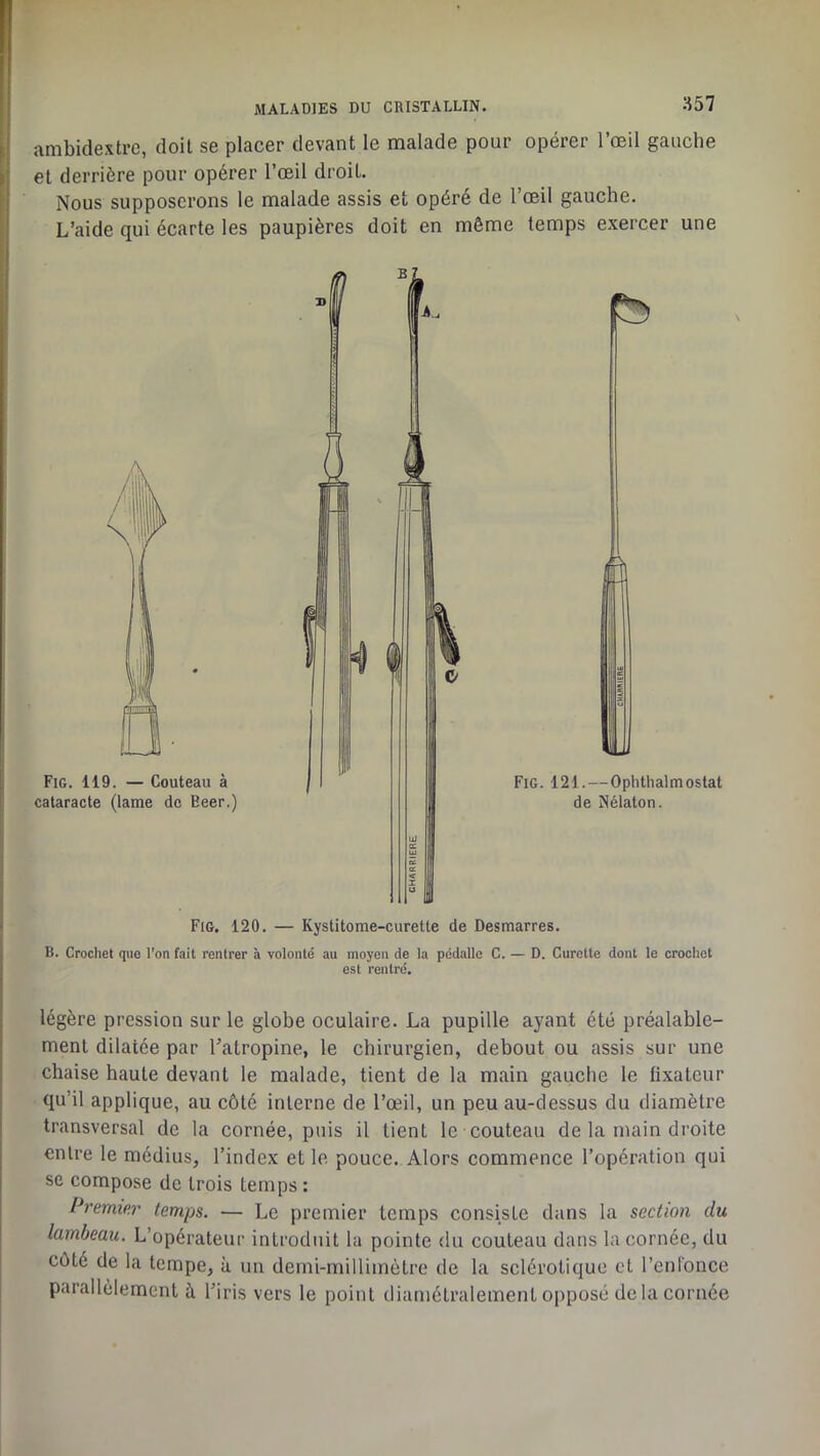 ambidextre, doit se placer devant le malade pour opérer l’œil gauche et derrière pour opérer l’œil droit. Nous supposerons le malade assis et opéré de l’œil gauche. L’aide qui écarte les paupières doit en même temps exercer une Fig. 120. — Kystitome-curette de Desmarres. B. Crochet que l’on fait rentrer à volonté au moyen de la pcdallo C. — D. Curette dont le crochet est rentré. légère pression sur le globe oculaire. La pupille ayant été préalable- ment dilatée par l’atropine, le chirurgien, debout ou assis sur une chaise haute devant le malade, tient de la main gauche le fixateur qu’il applique, au côté interne de l’œil, un peu au-dessus du diamètre transversal de la cornée, puis il lient le couteau de la main droite entre le médius, l’index et le pouce. Alors commence l’opération qui se compose de trois temps : Premier temps. — Le premier temps consiste dans la section du lambeau. L’opérateur introduit la pointe du couteau dans la cornée, du côté de la tempe, à un derni-rnilliinètre de la sclérotique et l’enfonce parallèlement à l’iris vers le point diamétralement opposé de la cornée