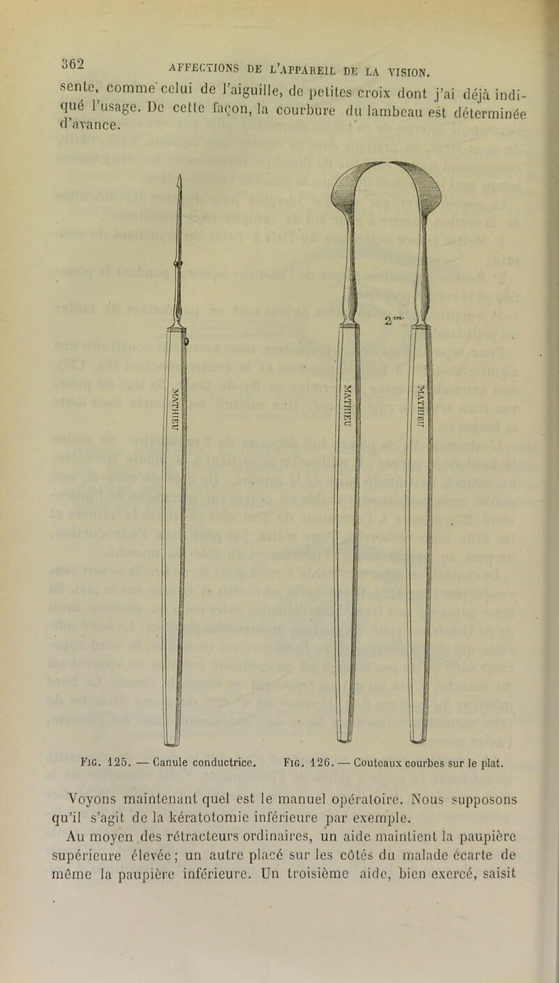 sente, comme celui de l’aiguille, de petites croix dont j’ai déjà indi- (jué 1 usage. De celte façon, la courbure du lambeau est déterminée d’avance. Fig. 125. —Canule conductrice. Fig. 126. — Couteaux courbes sur le plat. Voyons maintenant quel est le manuel opératoire. Nous supposons qu’il s’agit de la kératotomie inférieure par exemple. Au moyen des rélracteurs ordinaires, un aide maintient la paupière supérieure élevée; un autre placé sur les côtés du malade écarte de même la paupière inférieure. Un troisième aide, bien exercé, saisit