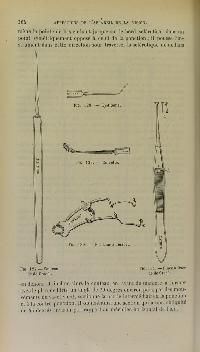 mène la pointe de bas en haut jusque sur le bord sclérotical dans un point symétriquement opposé à celui de la ponction ; il pousse Tin- strument dans cette direction pour traverser la sclérotique de dedans Fig. 127 —Couteau de de Graefe, Fig. 131. —Pince à fixer de de Graefe. en dehors. Il incline alors le couteau en avant de manière former avec le plan de l’iris un angle de 20 degrés environ puis, par des mou- vements de va-et-vient, sectionne la partie intermédiaire à la ponction et à la contre-ponction. 11 obtient ainsi une section qui a une obliquité de 45 degrés environ par rapport au méridien horizontal de l’œil.