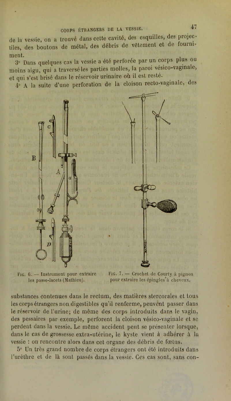 de la vessie, on a trouvé dans cette cavité, des esquilles, des projec- tiles, des boutons de métal, des débris de vêtement et de fourni ment. 3“ Dans quelques cas la vessie a été perforée par un corps plus ou moins aigu, qui a traversé les parties molles, la paroi vésico-vaginale, et qui s’est brisé dans te réservoir urinaire où il est resté. -1“ A la suite d’une perforation de la cloison recto-vaginale, des Fie. 6. — Instrument pour extraire Fie. 7. — Crochet de Courty à pignon les passe-lacets (Mathieu). pour extraire les épingles*à cheveux. substances contenues dans le rectum, des matières stercorales et tous les corps étrangers non digestibles qu’il renferme, peuvent passer dans le réservoir de l’urine; de môme des corps introduits dans le vagin, des pessaires par exemple, perforent la cloison vésico-vaginale et sc perdent dans la vessie. Le môme accident peut se présenter lorsque, dans le cas de grossesse extra-utérine, le kyste vient à adhérer h la vessie : on rencontre alors dans cet organe des débris de fœtus. 5 Un très grand nombre de corps étrangers ont été introduits dans Turèthre et de là sont passés dans la vessie. Ces cas sont, sans con-