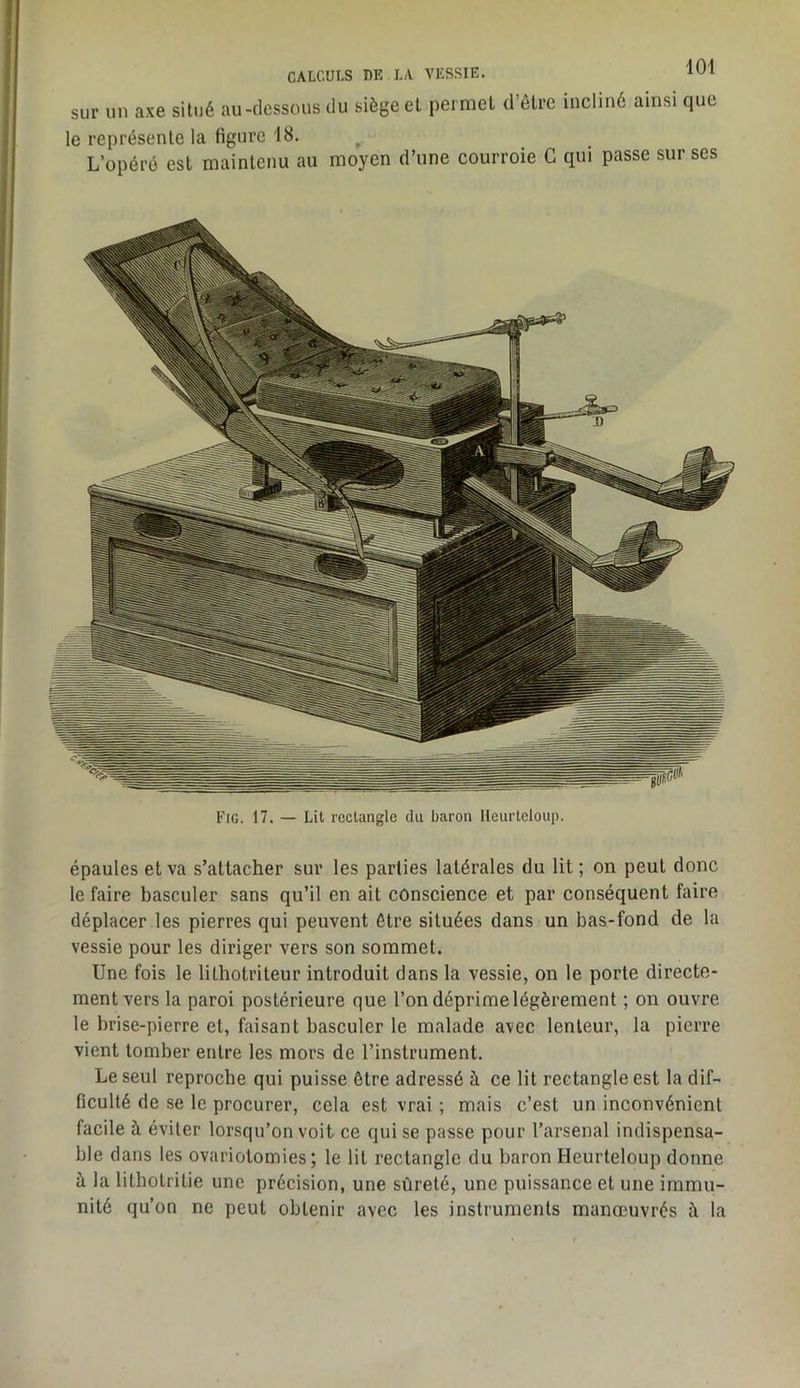 CALCULS DE LA VESSIE. sur un axe situé au-dessous du siège et permet d’êlrc incliné ainsi que le représente la figure 18. L’opéré est maintenu au moyen d’une courroie G qui passe sur ses Fig. 17. — Lit rectangle du baron lleiirteloup. épaules et va s’attacher sur les parties latérales du lit ; on peut donc le faire basculer sans qu’il en ait conscience et par conséquent faire déplacer les pierres qui peuvent être situées dans un bas-fond de la vessie pour les diriger vers son sommet. Une fois le lithotriteur introduit dans la vessie, on le porte directe- ment vers la paroi postérieure que l’on déprime légèrement ; on ouvre le brise-pierre et, faisant basculer le malade avec lenteur, la pierre vient tomber entre les mors de l’instrument. Le seul reproche qui puisse être adressé à ce lit rectangle est la dif- ficulté de se le procurer, cela est vrai ; mais c’est un inconvénient facile à éviter lorsqu’on voit ce qui se passe pour l’arsenal indispensa- ble dans les ovariotomies; le lit rectangle du baron Heurteloup donne à la lithotritie une précision, une sûreté, une puissance et une immu- nité qu’on ne peut obtenir avec les instruments manœuvrés à la