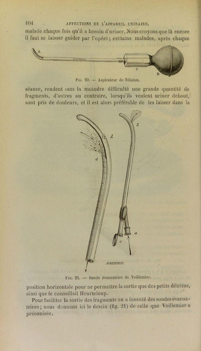 malade chaque fois qu’il a besoin d’uriiier. Nous croyons que là encore il faut se laisser guider par l’opéré; certains malades, après chaque Fiü. 20. — Aspirateur de Nùlalon. séance, rendent sans la moindre difficulté une grande quantité de fragments, d’antres au contraire, lorsqu’ils veulent uriner debout, sont pris de douleurs, et il est alors préférable de les laisser dans la position horizontale pour ne permettre la sortie que des petits détritus, ainsi que le conseillait lleurteloup. Pour faciliter la sortie des fragments on a inventé des sondes évacua- trices ; nous donnons ici le dessin (tig. l2l) de celle que Voillemiera préconisée.