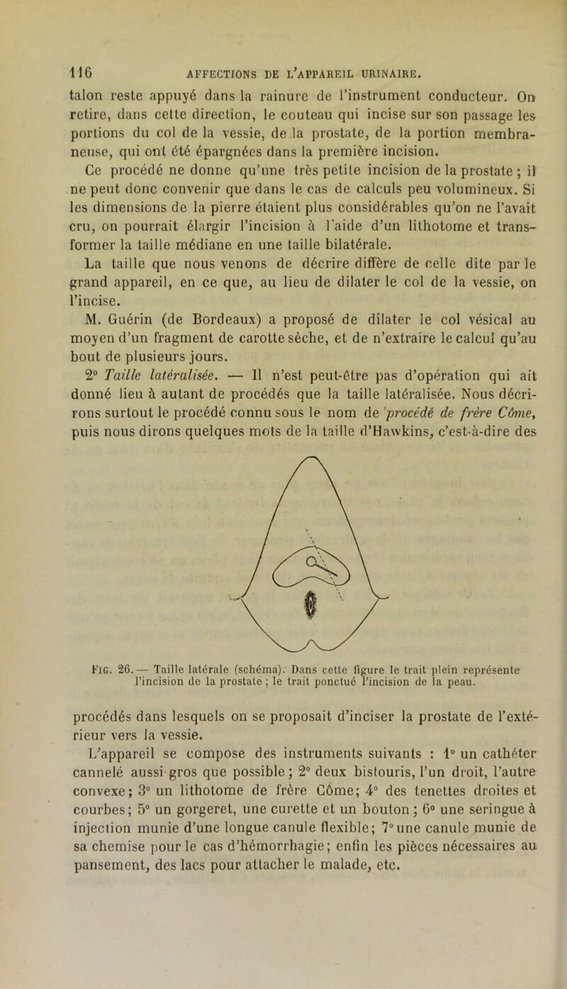 talon reste appuyé dans la rainure de rinslrument conducteur. On retire, dans cette direction, le couteau qui incise sur son passage les portions du col de la vessie, de la prostate, de la portion membra- neuse, qui ont été épargnées dans la première incision. Ce procédé ne donne qu’une très petite incision de la prostate ; il ne peut donc convenir que dans le cas de calculs peu volumineux. Si les dimensions de la pierre étaient plus considérables qu’on ne l’avait cru, on pourrait élargir l’incision à l’aide d’un lithotome et trans- former la taille médiane en une taille bilatérale. La taille que nous venons de décrire diffère de celle dite parle grand appareil, en ce que, au lieu de dilater le col de la vessie, on l’incise. M. Guérin (de Bordeaux) a proposé de dilater le col vésical au moyen d’un fragment de carotte sèche, et de n’extraire le calcul qu’au bout de plusieurs jours. 2® Taille latéralisée. — Il n’est peut-être pas d’opération qui ait donné lieu à autant de procédés que la taille latéralisée. Nous décri- rons surtout le procédé connu sous le nom de 'procédé de frère Côme, puis nous dirons quelques mots de la taille d’Hawkins, c’est-à-dire des Fig. 26.— Taille latérale (schéma). Dans celte figure le trait plein représente l’incision de la prostate ; le trait ponctué l’incision de la peau. procédés dans lesquels on se proposait d’inciser la prostate de l’exté- rieur vers la vessie. L’appareil se compose des instruments suivants : 1° un cathéter cannelé aussi gros que possible; 2® deux bistouris, l’un droit, l’autre convexe; 3® un lithotome de frère Côme; 4® des tenettes droites et courbes; 5® un gorgeret, une curette et un bouton; 6® une seringue à injection munie d’une longue canule flexible; 7®une canule munie de sa chemise pour le cas d’hémorrhagie; enfin les pièces nécessaires au pansement, des lacs pour attacher le malade, etc.