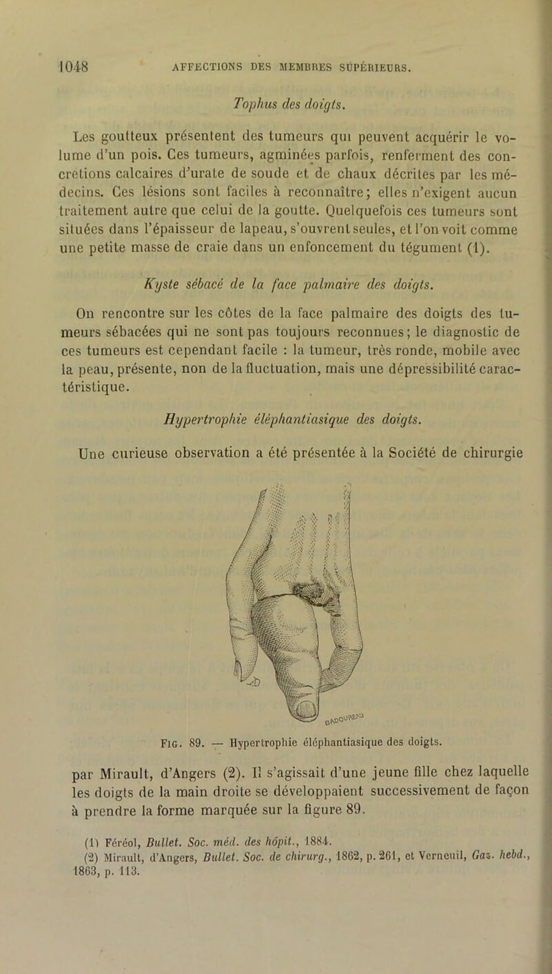 Tophus des doigts. Les goutteux présentent des tumeurs qui peuvent acquérir le vo- lume d’un pois. Ces tumeurs, agminées parfois, renferment des con- crétions calcaires d’urale de soude et de chaux décrites par les mé- decins. Ces lésions sont faciles à reconnaître; elles n’exigent aucun traitement autre que celui de la goutte. Quelquefois ces tumeurs sont situées dans l’épaisseur de lapeau, s’ouvrent seules, et l’on voit comme une petite masse de craie dans un enfoncement du tégument (1). On rencontre sur les côtes de la face palmaire des doigts des tu- meurs sébacées qui ne sont pas toujours reconnues ; le diagnostic de ces tumeurs est cependant facile : la tumeur, très ronde, mobile avec la peau, présente, non de la fluctuation, mais une dépressibilité carac- téristique. Une curieuse observation a été présentée à la Société de chirurgie par Mirault, d’Angers (2). Il s’agissait d’une jeune fille chez laquelle les doigts de la main droite se développaient successivement de façon à prendre la forme marquée sur la figure 89. (1> Féréol, Bullet. Soc. méd. des liôpit., 1884. (2) Mirault, d’Angers, Bullet. Soc. de chirurg., 1862, p.261, et Verneuil, Gaz. hebd., 1863, p. 113. Kyste sébacé de la face palmaire des doigts. Hypertrophie éléphantiasique des doigts. FiG. 89. — Hypertrophie éléphantiasique des doigts.