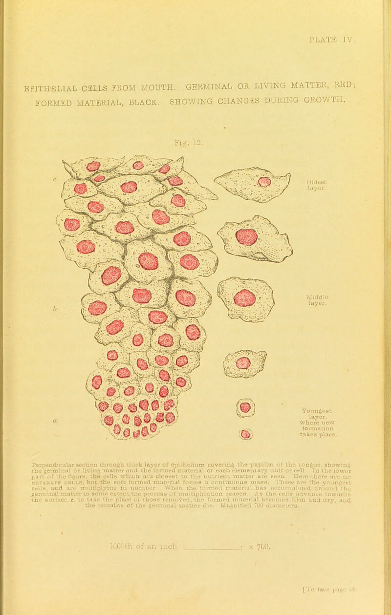 FORMED MATERIAL, BLAOK. SHOWING CHANGES DURING GROWTH. Fig. 12. (HdeSt layer. Middle layer. Youngest layer, wbci'e new lormation takes place. Perpendicular section through thick layer of epithelium covering the papilla? ot the tongue, showing The germinal or liviug matter and the toitned matenal or each elementary unit or cell In the lower part of the figure, the cells which are closest to the nutrient matter are seen Here there are no sefahaif culls, but the soft formed material forms a continuous m iss. These are the youngest cells, and are rrtdtiplyiug iu number When the formed material lias accumulated around the germinal matter to some extent rue process of multiplication (eases As the cells advance towards th- surrace, c. to tike the place of those removed, the formed material becomes firm and dry, and the remains oi the germinal matter die. Magnified TOO diameters. IGGGth of an inch \ ; x 700. | lo luce pagt •«&