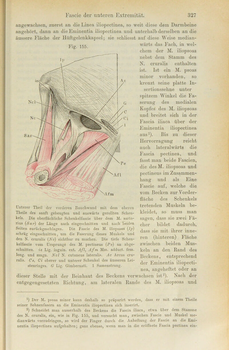 Fig. 155. angewachsen, zuerst an die Linea iliopectinea, so weit diese dem Darmbeine angehört, dann an die Eminentia iliopectinea und unterhalb derselben an die äussere Fläche der Hüftgelenkkapsel; sie schliesst auf diese Weise median- wärts das Fach, in wel- chem der M. iliopsoas nebst dem Stamm des N. cruralis enthalten ist. Ist ein M. psoas minor vorhanden, so kreuzt seine platte In- sertionssehne unter spitzem Winkel die Fa- serung des medialen Kopfes des M. iliopsoas und breitet sich in der Fascia iliaca über der Eminentia iliopectinea aus1). Bis zu dieser Hervorragung reicht auch lateralwärts die Fascia pectinea, und fasst man beide Fascien, die des M. iliopsoas und pectineus im Zusammen- hang und als Eine Fascie auf, welche die vom Becken zur Yorder- fläche des Schenkels tretenden Muskeln be- kleidet, so muss man sagen, dass sie zwei Fä- cher bildet dadurch, dass sie mit ihrer inne- ren (hinteren) Fläche zwischen beiden Mus- keln an den Rand des Beckens, entsprechend der Eminentia iliopecti- nea, angeheftet oder an Unterer Theil der vorderen Bauchwand mit dem oberen Theile des sanft gebeugten und auswärts gerollten Schen- kels. Die oberflächliche Schenkelfascie über dem M. sarto- rius (Sar) der Länge nach eingeschnitten und nach beiden Seiten zurückgeschlagen. Die Fascie des M. iliopsoas (Iß) schräg eingeschnitten, um die Faserung dieses Muskels und den N. cruralis (iVc) sichtbar zu machen. Die tiefe Schen- kelfascie vom Ursprungb des M. pectineus (Pe) an abge- schnitten. ie Lig. iuguin. ext. Afl, Afm Mm. adduct. fern, long. und nragn. Ncl N. cutaneus lateralis. Ac Arcus cru- ralis. Cs, Ci oberer und unterer Schenkel des äusseren Lei- stenringes. G Lig. Gimbernati. 1 Samenstrang. dieser Stelle mit der Beinhaut entgegengesetzten Richtung, des Beckens verwachsen ist2). Nach der am lateralen Rande des M. iliopsoas und b Der M. psoas minor kann deshalb so präparirt werden, dass er mit einem Theile seiner Sehnenfasern an die Eminentia iliopectinea sich inserirt. 2) Schneidet man ausserhalb des Beckens die Fascia iliaca, etwa über dem Stamme des N. cruralis, ein, wie in Fig. 155, und versucht man, zwischen Fascie und Muskel me- dianwärts vorzudringen, so wird der Finger durch die Anheftung der Fascie an die Emi- nentia iliopectinea aufgehalten; ganz ebenso, wenn man in die eröffnete Fascia pectinea ein-