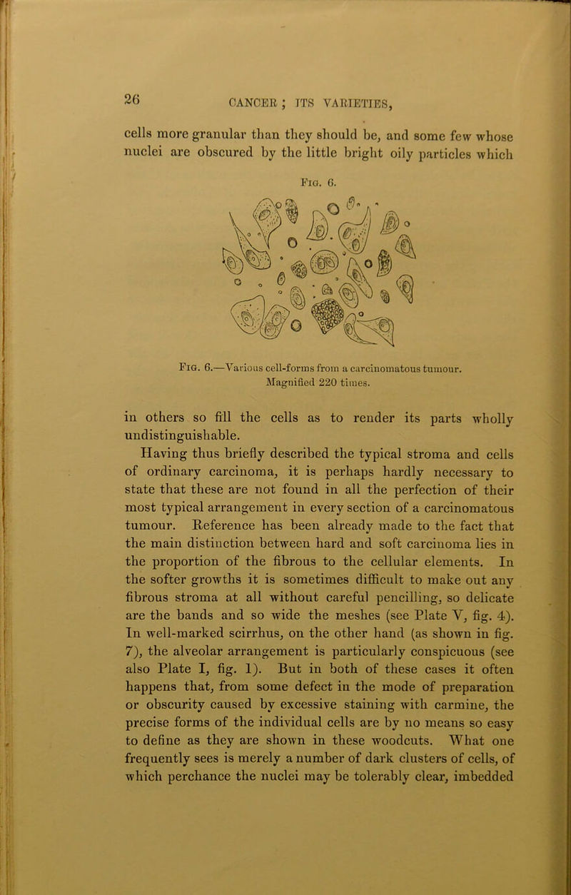 cells more granular than they should be, and some few whose nuclei are obscured by the little bright oily particles which Eio. G. Fig. 6.—Various cell-forms from a carcinomatous tumour. Magnified 220 times. in others so fill the cells as to render its parts wholly undistinguishable. Having thus briefly described the typical stroma and cells of ordinary carcinoma, it is perhaps hardly necessary to state that these are not found in all the perfection of their most typical arrangement in every section of a carcinomatous tumour. Reference has been already made to the fact that •/ the main distinction between hard and soft carcinoma lies in the proportion of the fibrous to the cellular elements. In the softer growths it is sometimes difficult to make out any fibrous stroma at all without careful pencilling, so delicate are the bands and so wide the meshes (see Plate V, fig. 4). In well-marked scirrhus, on the other hand (as shown in fig. 7), the alveolar arrangement is particularly conspicuous (see also Plate I, fig. 1). But in both of these cases it often happens that, from some defect in the mode of preparation or obscurity caused by excessive staining with carmine, the precise forms of the individual cells are by no means so easy to define as they are shown in these woodcuts. What one frequently sees is merely a number of dark clusters of cells, of which perchance the nuclei may be tolerably clear, imbedded