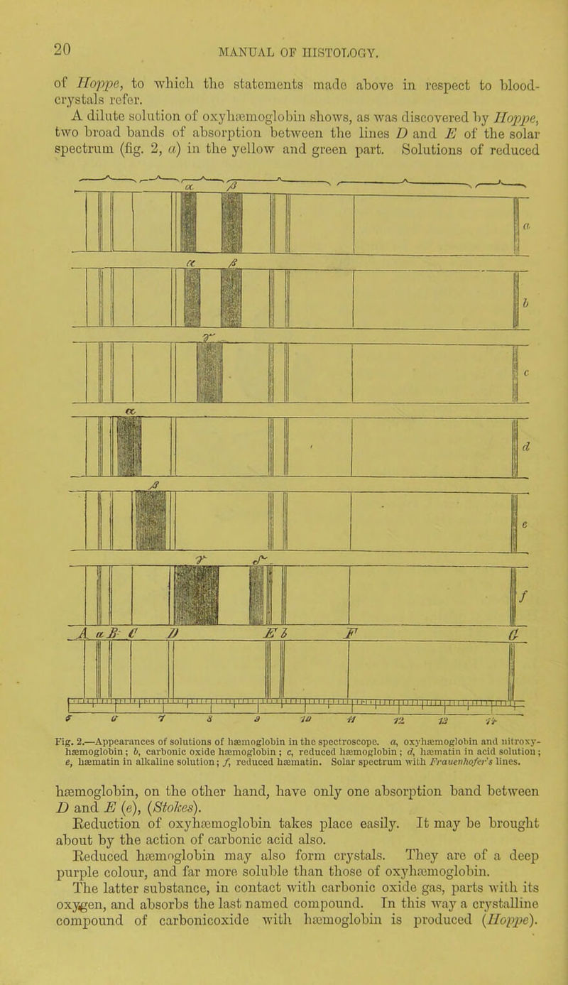 of Hoppe, to which the statements made above in respect to blood- crystals refer. A dilute solution of oxyhannoglobin shows, as was discovered by Iloppe, two broad bands of absorption between the lines D and E of the solar spectrum (fig. 2, a) in the yellow and green part. Solutions of reduced Fig. 2.—Appearances of solutions of haemoglobin in the spectroscope, a, oxyhajmoglohin and nitroxy- hsemoglobin; b, carbonic oxide haemoglobin ; c, reduced haemoglobin ; rf, haematin in acid solution; e, haematin in alkaline solution; /, reduced liaematin. Solar spectrum with Frauenhofer's lines. haemoglobin, on the other hand, have only one absorption band between D and E (e), (Stokes). Seduction of oxyhaemoglobin takes place easily. It may be brought about by the action of carbonic acid also. Seduced haemoglobin may also form crystals. They arc of a deep purple colour, and far more soluble than those of oxyhaemoglobin. The latter substance, in contact with carbonic oxide gas, parts with its oxygen, and absorbs the last named compound. Tn this way a crystalline compound of carbonicoxide with haemoglobin is produced (Hoppe).