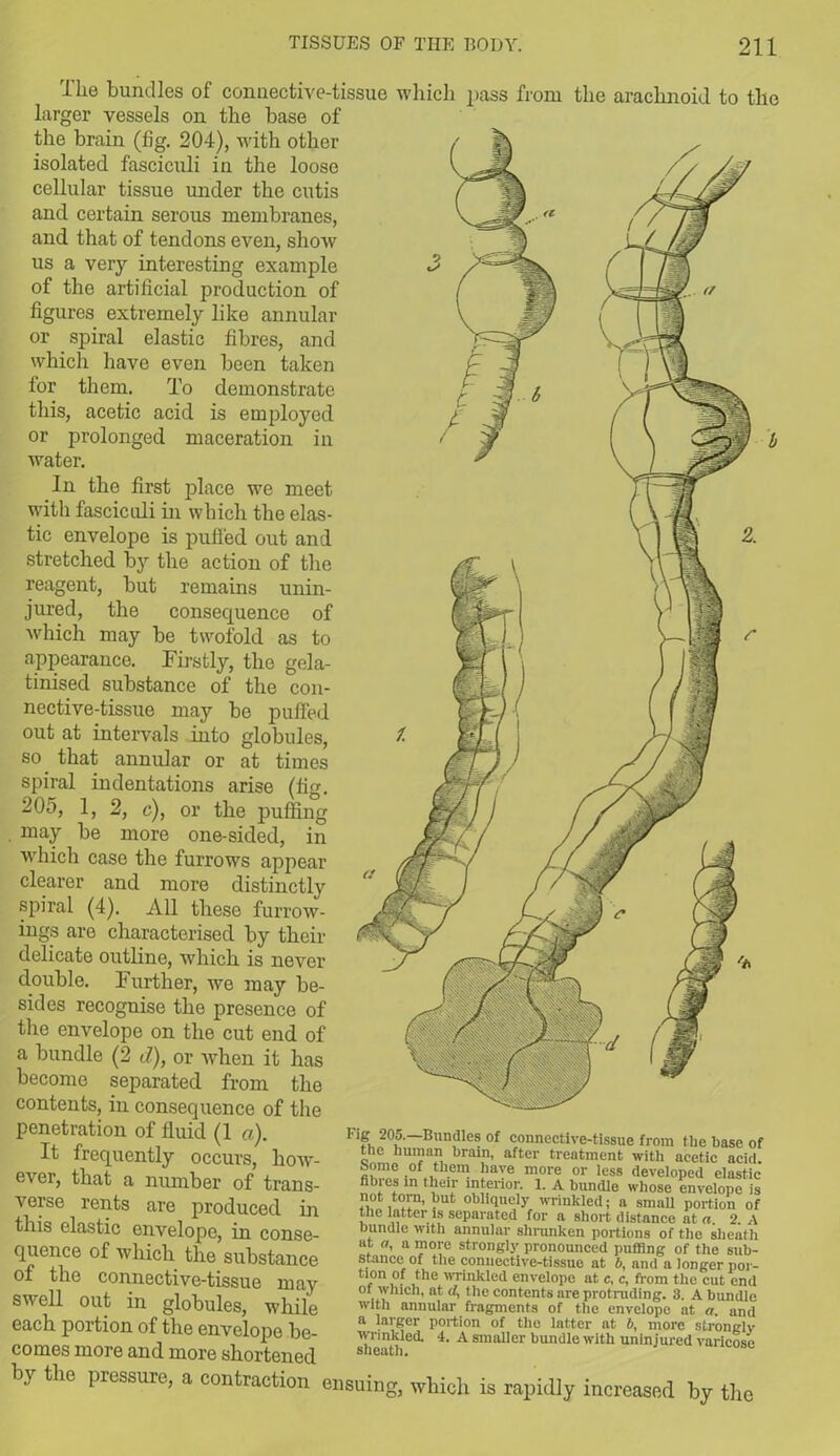 The bundles of connective-tissue which pass from the arachnoid to the larger vessels on the base of the brain (fig. 204), with other isolated fasciculi in the loose cellular tissue under the cutis and certain serous membranes, and that of tendons even, show us a very interesting example of the artificial production of figures extremely like annular or spiral elastic fibres, and which have even been taken for them. To demonstrate this, acetic acid is employed or prolonged maceration in water. In the first place we meet with fasciculi in which the elas- tic envelope is puffed out and stretched by the action of the reagent, but remains unin- jured, the consecpience of which may be twofold as to appearance. Firstly, the gela- tinised substance of the con- nective-tissue may be puffed out at intervals into globules, so that annular or at times spiral indentations arise (fig. 205, 1, 2, c), or the puffing . may be more one-sided, in which case the furrows appear clearer and more distinctly spiral (4). All these furrow- in gs are characterised by their delicate outline, which is never double. Further, we may be- sides recognise the presence of the envelope on the cut end of a bundle (2 d), or when it has become separated from the contents, in consequence of the penetration of fluid (1 a). It frequently occurs, how- ever, that a number of trans- verse rents are produced hi this elastic envelope, in conse- quence of which the substance of the connective-tissue may swell out in globules, while each portion of the envelope be- comes more and more shortened by the pressure, a contraction ensuing, which is rapidly increased by the 1‘5, 20fBun,dle? of connective-tissue from the base of the human brain, after treatment with acetic acid some of them have more or less developed elastic fibres in their interior. 1. A bundle whose envelope is not torn, but obliquely wrinkled; a small portion of the latter is separated for a short distance at a 2. A bundle with annular shrunken portions of the sheath at a, a more strongly pronounced putting of the sub- stance of the connective-tissue at b, and a longer por- tion of the wrinkled envelope at c, c, from the cut end of which, at cl, the contents are protruding. 3. A bundle with annular fragments of the envelope at a. and a larger portion of the latter at b, more stronglv wrinkled. 4. A smaller bundle with uninjured varicose