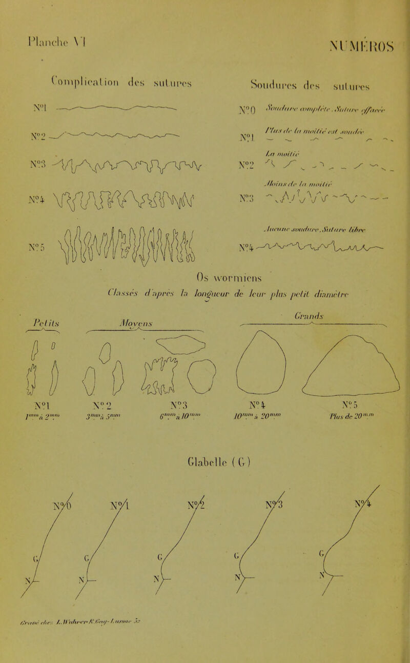 l’hinrilc \'l MMKIîOS ^ ompl i(*nl ion (les Mil 111‘es Soiidni'es d('s suluees N‘M ^’O Q .S'dUf/nrr n>tii/i/rf,-. SnliiiH- N?l N‘!2 N‘::5 /‘(it.iiti- la moitii'!‘.H .vomira — — l.a nioilir ^ s. ^ ^ ^ .Itoin.v (Ir la naiilir Os wormiens C /<i.s-.sY*.v d nprcs la longueur de leur plus peliL diamèlre Petits 1} Grands A love ns Glabelh’: { ('» ) O‘roi»' i-hr-.-. /. // ’ii/irrr/> .(■’>«/- /. ii.ntir