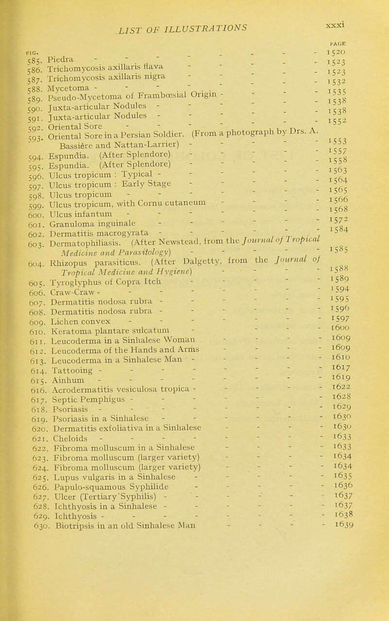 585- 586. 587. 588. 589. 590. S9I. 592. 593- 594- 595- 596. 597- 598. 599- 600. 601. 602. 603. 004. 605. 606. 607. 608. 609. 610. 611. 612. 613. 614. 615. 616. 617. 618. 619. 620. 621. 622. 623. 624, 625, 626 627 628 629 630 with Cornu cutaneum Piedra - -  Trichomycosis axillaris Hava - -  Trichomycosis axillaris nigra - -   Mycetoma - - ■ ' . . ' Pseudo-Mycetoma of FrambcEsial Origm - - - Juxta-articular Nodides Juxta-articular Nodules Oriental Sore - - ' ,it,taa Oriental Sore in a Persian Soldier. (From a photograph by Drs. A Bassiere and Nattan-Larrier) - -   Espundia. (After Splendore) - -  ' Espundia. (After Splendore) - -   Ulcus tropicum : Typical - -   ' Ulcus tropicum : Early Stage - -   Ulcus tropicum Ulcus tropicum, Ulcus infantum Granuloma inguinale Dermatitis macrogyrata - - - ' , ^- '7 Dermatophiliasis. (After Newstead, from the Journal of Tropical Medicine and Parasitology) - -   Rhizopus parasiticus. (After Dalgetty, from the Journal of Tropical Medicine and Hygiene) - ■ - Tyroglyphus of Copra Itch - - '   Craw-Craw» Dermatitis nodosa rubra Dermatitis nodosa rubra Lichen convex Keratoma plantare sulcatum - - '  Leucoderma in a Sinhalese Woman - - -  Leucoderma of the Hands and Arrhs - - -  Leucoderma in a Sinhalese Man - Tattooing Ainhum -------- Acrodermatitis vesiculosa tropica - - - -  Septic Pemphigus - - - - ■ Psoriasis - - - Psoriasis in a Sinhalese Dermatitis exfoliativa in a Sinhalese - - - - Cheloids Fibroma molluscum in a Sinhalese - - - - Fibroma molluscum (larger variety) . - - - Fibroma molluscum (larger variety) - - Lupus vulgaris in a Sinhalese - - - -  Papulo-squamous Syphilide . . - - • Ulcer (Tertiary'Syphilis) - - Ichthyosis in a Sinhalese ------ , Ichthyosis , Biotripsis in an old Sinhalese Man PAGE 1520 1523 1523 1532 1535 1538 1538 1552 1553 1557 1558 1563 1564 1565 1566 1568 1572 1584 1585 1588 1589 1594 1595 iS9(--, 1597 1600 1609 1609 161U 1617 1619 1622 1628 1629 1630 163U 1633 1633 1634 1634 1635 1636 1637 1637 1638 ■ 1639