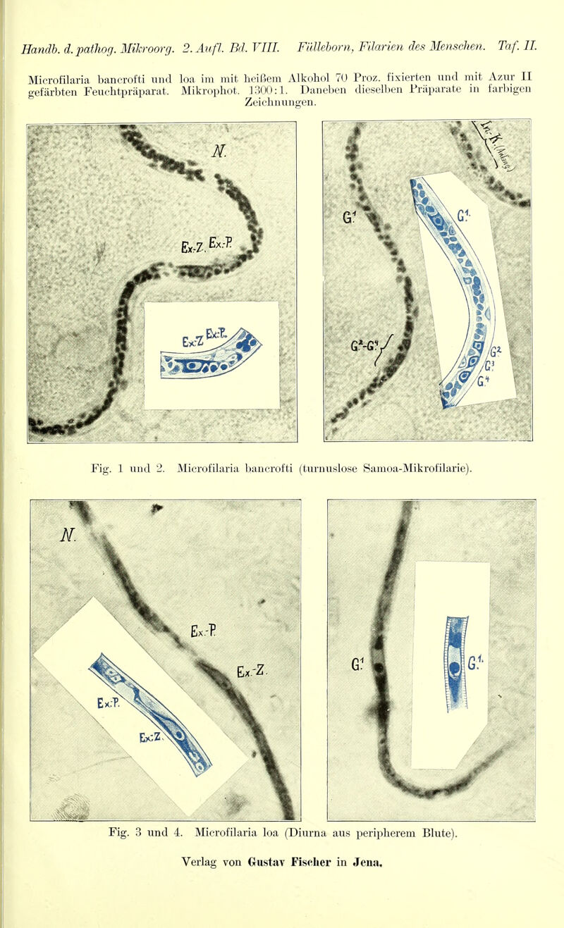 Microfilaria bancrofti mid loa im mit heifiem Alkohol 70 Proz. fixierten und mit Azur II gefiirbten Feuchtpriiparat. Mikrophot. ] 300:1. Daneben dieselben Fraparate in farbigen Zeicbnungen. Fig. 1 und 2. Microfilaria bancrofti (turnuslose Samoa-Mikrofilarie). Fig. 3 und 4. Microfilaria loa (Diurna aus peripherem Blute). Verlag von Gustav Fischer in Jeiia.