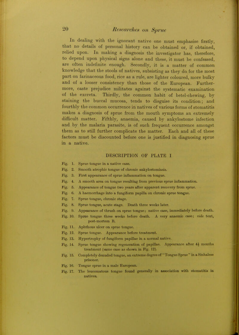 In dealing with the ignorant native one must emphasise firstly, that no details of personal history can be obtained or, if obtained, relied upon. In making a diagnosis the investigator has, therefore, to depend upon physical signs alone and these, it must be confessed, are often indefinite enough. Secondly, it is a matter of common knowledge that the stools of natives, subsisting as they do for the most part on farinaceous food, rice as a rule, are lighter coloured, more bulky and of a looser consistency than those of the European. Further- more, caste prejudice militates against the systematic examination of the excreta. Thirdly, the common habit of betel-chewing, by staining the buccal mucosa, tends to disguise its condition; and fourthly the common occurrence in natives of various forms of stomatitis makes a diagnosis of sprue from the mouth symptoms an extremely difficult matter. Fifthly, anaemia, caused by ankylostome infection and by the malaria parasite, is of such frequent occurrence amongst them as to still further complicate the matter. Each and all of these factors must be discounted before one is justified in diagnosing sprue in a native. DESCRIPTION OF PLATE I Fig. 1. Sprue tongue in a native case. Fig. 2. Smooth atrophic tongue of chronic ankylostomiasis. Fig. 3. First appearance of sprue inflammation on tongue. Fig. 4. A smooth area on tongue resulting from previous sprue inflammation. Fig. 5. Appearance of tongue two years after apparent recovery from sprue. Fig. 6. A haemorrhage into a fungiform papilla on chronic sprue tongue. Fig. 7. Sprue tongue, chronic stage. Fig. 8. Sprue tongue, acute stage. Death three weeks later. Fig. 9. Appearance of thrush on sprue tongue; native case, immediately before death. Fig. 10. Sprue tongue three weeks before death. A very anaemic case; vide text, post-mortem B. Fig. 11. Aphthous ulcer on sprue tongue. Fig. 12. Sprue tongue. Appearance before treatment. Fig. 13. Hypertrophy of fungiform papillae in a normal native. Fig. 14. Sprue tongue showing regeneration of papillae. Appearance after 4i months treatment (same case as shown in Fig. 12). Fig. 15. Completely denuded tongue, an extreme degree of Tongue Sprue in a Sinhalese prisoner. Fig. 16. Tongue sprue in a male European. Fig. 17. The leucomatous tongue found generally in association with stomatitis in natives.
