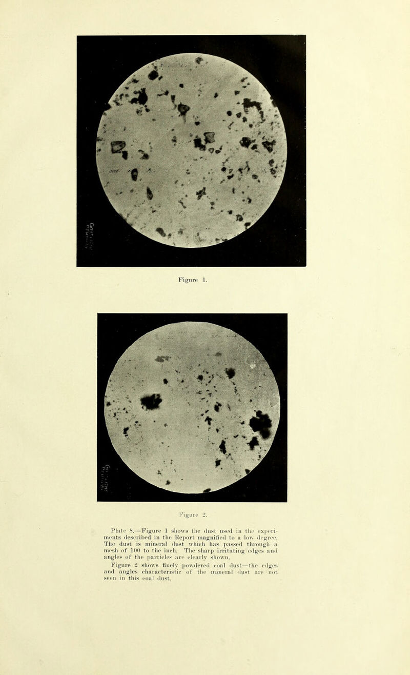 ,-,o 9 Figure 1. Figure 2. Plate S.—Figure 1 shows the dust used in the experi- ments described in the Report magnified to a low degree. The dust is mineral dust which has passed through a mesh of 100 to the inch. The sharp irritating edges and angles of the particles are clearly shown. Figure 2 shows finely powdered coal dust—the edges and angles characteristic of the mineral dust are not seen in tins coal dust.