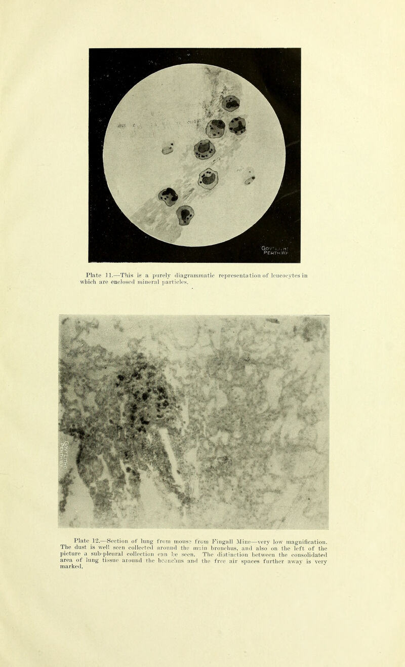 Plate 11.—This is a purely diagrammatic representation of leucocytes in which are enclosed mineral particles. Plate 12.—Section of lung from mouse from Fingall hline—very low magnification. The dust is well seen collected around the main bronchus, and also on the left of the picture a sub-pleural collection can be seen. The distinction between the consolidated area of lung tissue around the bronchus and the free air spaces further away is very marked.