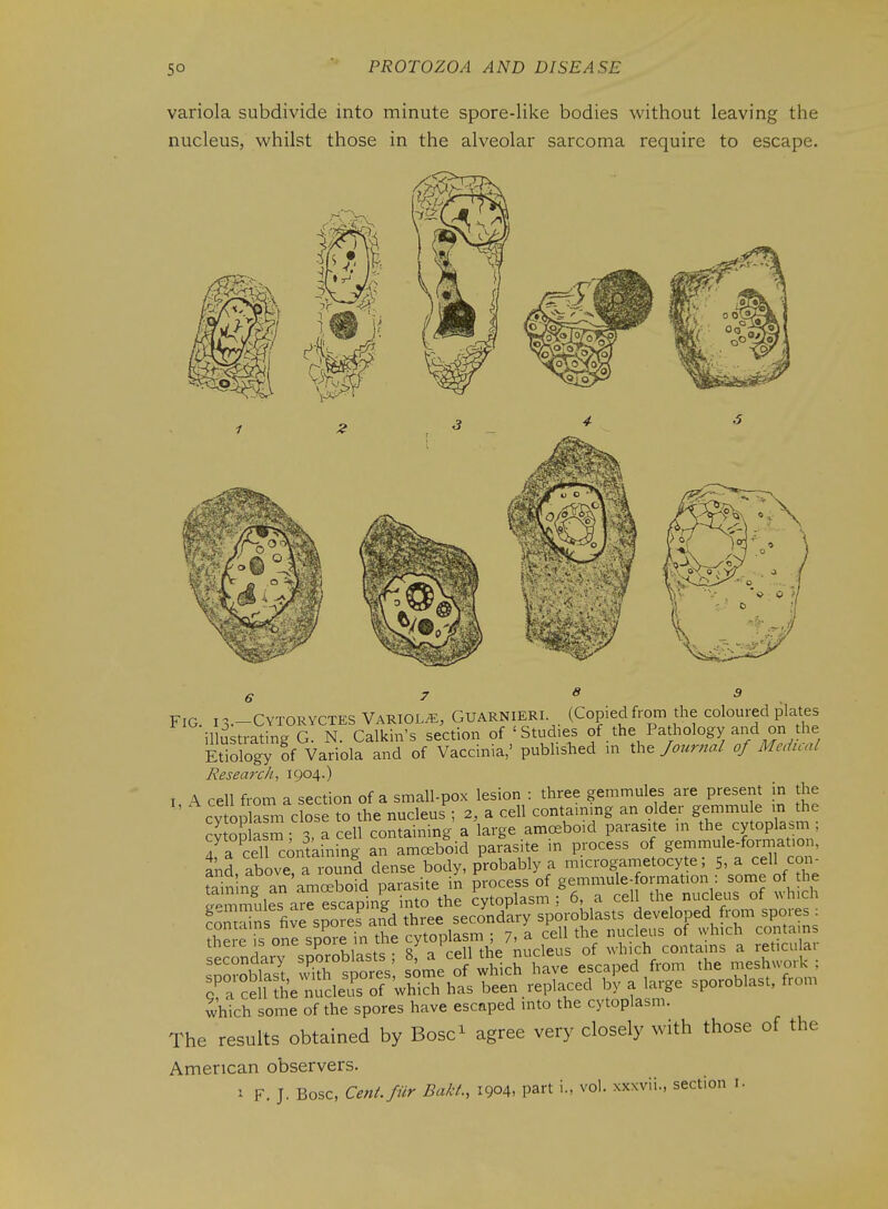 variola subdivide into minute spore-like bodies without leaving the nucleus, whilst those in the alveolar sarcoma require to escape. Fig 13.-CYTORYCTES Variol/E, Guarnieri. (Copied from the coloured plates illustrating G. N. Calkin's section of 'Studies of the Pathology and on the Etiology of Variola and of Vaccinia,' published in the /ourna/ of Medual Research, 1904.) I A cell from a section of a small-pox lesion : three gemmules are present in the cvtoplaSi^ close to the nucleus ; 2, a cell containing an older gemmule m the cSSn ; 3. a cell containing a large amceboid parasite in the cytoplasm ; 7a cell containing an amoeboid parasite in process of gemmule-format.on, and above a i-ound dense body, probably a microgametocyte; 5, a cell con- which some of the spores have escaped mto the cytoplasm. The results obtained by Bosc^ agree very closely with those of the American observers. 1 F. J. Bosc, CenL/fir Bakt, 1904, part i., vol. xxxvii., section i.