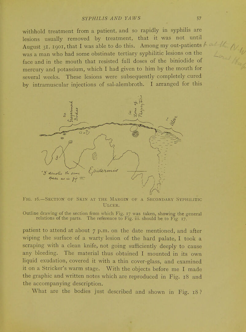 withhold treatment from a patient, and so rapidly in syphilis are lesions usually removed by treatment, that it was not until August 31, .1901, that I was able to do this. Among my out-patients f was a man who had some obstinate tertiary syphilitic lesions on the face and in the mouth that resisted full doses of the biniodide of mercury and potassium, which I had given to him by the mouth for several weeks. These lesions were subsequently completely cured by intramuscular injections of sal-alembroth. I arranged for this Fig. 16.—Section of Skin at the Margin of a Secondary Syphilitic Ulcer. Outline drawing of the section from which Fig. 17 was taken, showing the general relations of the parts. The reference to Fig. iii. should be to Fig 17. patient to attend at about 7 p.m. on the date mentioned, and after wiping the surface of a warty lesion of the hard palate, I took a scraping with a clean knife, not going sufficiently deeply to cause any bleeding. The material thus obtained I mounted in its own liquid exudation, covered it with a thin cover-glass, and examined it on a Strieker's warm stage. With the objects before me I made the graphic and written notes which are reproduced in Fig. 18 and the accompanying description. What are the bodies just described and shown in Fig. 18 ?