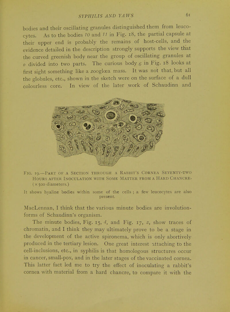 bodies and their oscillating granules distinguished them from leuco- cytes. As to the bodies 10 and // in Fig. i8, the partial capsule at their upper end is probably the remains of host-cells, and the evidence detailed in the description strongly supports the view thiat the curved greenish body near the group of oscillating granules at 0 divided into two parts. The curious body § in Fig. i8 looks at first sight something like a zoogloea mass. It was not that, but all the globules, etc., shown in the sketch were on the surface of a dull colourless core. In view of the later work of Schaudinn and 1\ - - „- Fig. 19.—Part of a Section through a Rabbit's Cornea Seventy-two Hours after Inoculation with Some Matter from a Hard Chancre- (X 500 diameters.) It shows hyaline bodies within some of the cells ; a few leucocytes are also present. MacLennan, I think that the various minute bodies are involution- forms of Schaudinn's organism. The minute bodies. Fig. 15, 4, and Fig. 17, 2, show traces of chromatin, and I think they may ultimately prove to be a stage in the development of the active spironema, which is only abortively produced in the tertiary lesion. One great interest attaching to the cell-inclusions, etc., in syphiHs is that homologous structures occur in cancer, small-pox, and in the later stages of the vaccinated cornea. This latter fact led me to try the effect of inoculating a rabbit's cornea with material from a hard chancre, to compare it with the