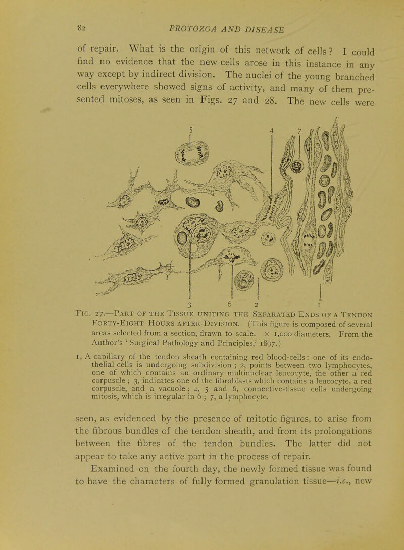 of repair. What is the origin of this network of cells ? I could find no evidence that the new cells arose in this instance in any way except by indirect division. The nuclei of the young branched cells everywhere showed signs of activity, and many of them pre- sented mitoses, as seen in Figs. 27 and 28. The new cells were 'It it si /• 1^ ^ ^^^^ Ci Fig. 27—Part of the Tissue uniting the Separated Ends of a Tendon Forty-Eight Hours after Division. (This figure is composed of several areas selected from a section, drawn to scale, x 1,000 diameters. From the Author's 'Surgical Pathology and Principles,' 1897.) I, A capillary of the tendon sheath containing red blood-cells: one of its endo- thelial cells is undergoing subdivision ; 2, points between two lymphocytes, one of which contains an ordinary multinuclear leucocyte, the other a red corpuscle ; 3, indicates one of the fibroblasts which contains a leucocyte, a red corpuscle, and a vacuole ; 4, 5 and 6, connective-tissue cells undergoing mitosis, which is irregular in 6 ; 7, a lymphocyte. seen, as evidenced by the presence of mitotic figures, to arise from the fibrous bundles of the tendon sheath, and from its prolongations between the fibres of the tendon bundles. The latter did not appear to take any active part in the process of repair. Examined on the fourth day, the newly formed tissue was found to have the characters of fully formed granulation tissue—i.e., new
