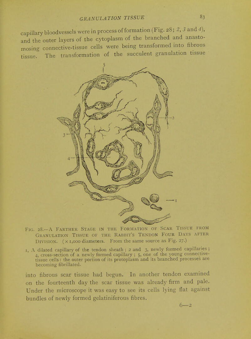 capillary bloodvessels were in process of formation (Fig. 28; 2, 3 and 4), and the outer layers of the cytoplasm of the branched and anasto- mosing connective-tissue cells were being transformed into fibrous tissued The transformation of the succulent granulation tissue Fig. 28.—a Farther Stage in the Formation of Scar Tissue from Granulation Tissue of the Rabbit's Tendon Four Days after Division. ( x 1,000 diameters. From the same source as Fig. 27.) I, A dilated capillary of the tendon sheath ; 2 and 3, newly formed capillaries ; 4, cross-section of a newly formed capillary ; 5, one of the young connective- tissue cells: the outer portion of its protoplasm and its branched processes are becoming fibrillated. into fibrous scar tissue had begun. In another tendon examined on the fourteenth day the scar tissue was already firm and pale. Under the microscope it was easy to see its cells lying flat against bundles of newly formed gelatiniferous fibres. 6—2