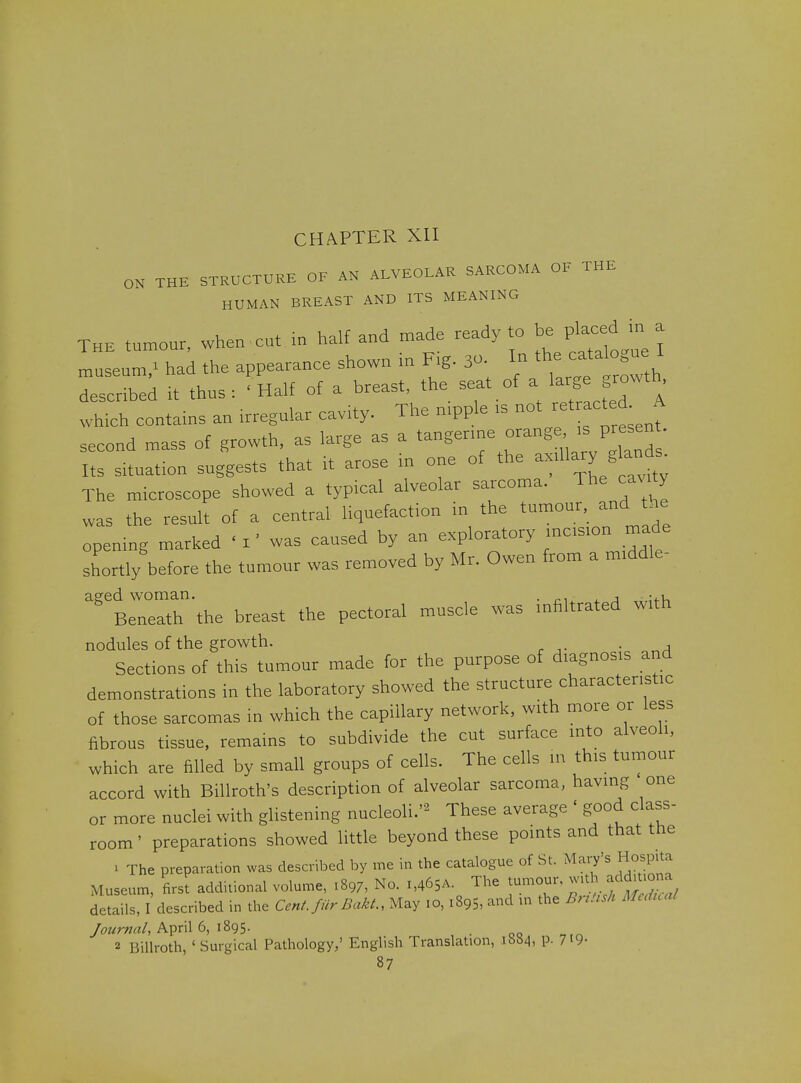 ON THE STRUCTURE OF AN ALVEOLAR SARCOMA OF THE HUMAN BREAST AND ITS MEANING THE tumour, when cut m half and made ready to be Pl-ed |n a museum/ had the appearance shown in F.g. 30. In catabgue I described it thus : ' Half of a breast, the seat of a 1-?^ .vhich contains an .rregular cav.ty. The mpple ,s -' -t acted A second mass of growth, as large as a '-g-^^^'^^^!; ^/^^s Its situation suggests that it arose in one of the -.Hary g ands^ The microscope showed a typical alveolar sarcoma. The cavity was the result of a central liquefaction in the tumour, and the opening marked ' I' was caused by an exploratory mcsion made shortly before the tumour was removed by Mr. Owen from a m.ddle- aered woman. . „, ^ , -.i Beneath the breast the pectoral muscle was mfiltrated with nodules of the growth. . Sections of this tumour made for the purpose of diagnosis and demonstrations in the laboratory showed the structure characteristic of those sarcomas in which the capillary network, with more or less fibrous tissue, remains to subdivide the cut surface into alveoli, which are filled by small groups of cells. The cells in this tumour accord with Billroth's description of alveolar sarcoma, having one or more nuclei with glistening nucleoli.'^ These average ' good class- room ' preparations showed little beyond these points and that ttie 1 The preparation was described by me in the catalogue of St. Mary's Hospita Museum, first additional volume, 1897, No. i,465A. ^^^^ ^T'^^^.f ^J^X!/ details, I described in the Cent, fiir BakL, May 10, 1895, and m the BrtUsh Mcdual April 6, 1895. 2 Billroth, ' Surgical Pathology,' English Translation, ib84, P- 7i9-
