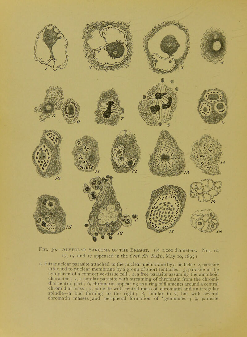 13, 15, and 17 appeared in the Cent, fur Baki., May 10, 1895.) I, Intranuclear parasite attached to the nuclear membrane by a pedicle ; 2, parasite attached to nuclear membrane by a group of short tentacles ; 3, parasite in the cytoplasm of a connective-tissue cell ; 4, a free parasite assuming the ama>boid character ; 5, a similar parasite with streaming of chromatin from the chromi- dial central part; 6, chromatin appearing as a ring of filaments around a central chromidial mass ; 7, parasite with central mass of chromatin and an irregular spindle—a bud forming to the right ; 8, similar to 7, but with several chromatin masses |^and peripheral formation of 'gemmules'; 9, parasite