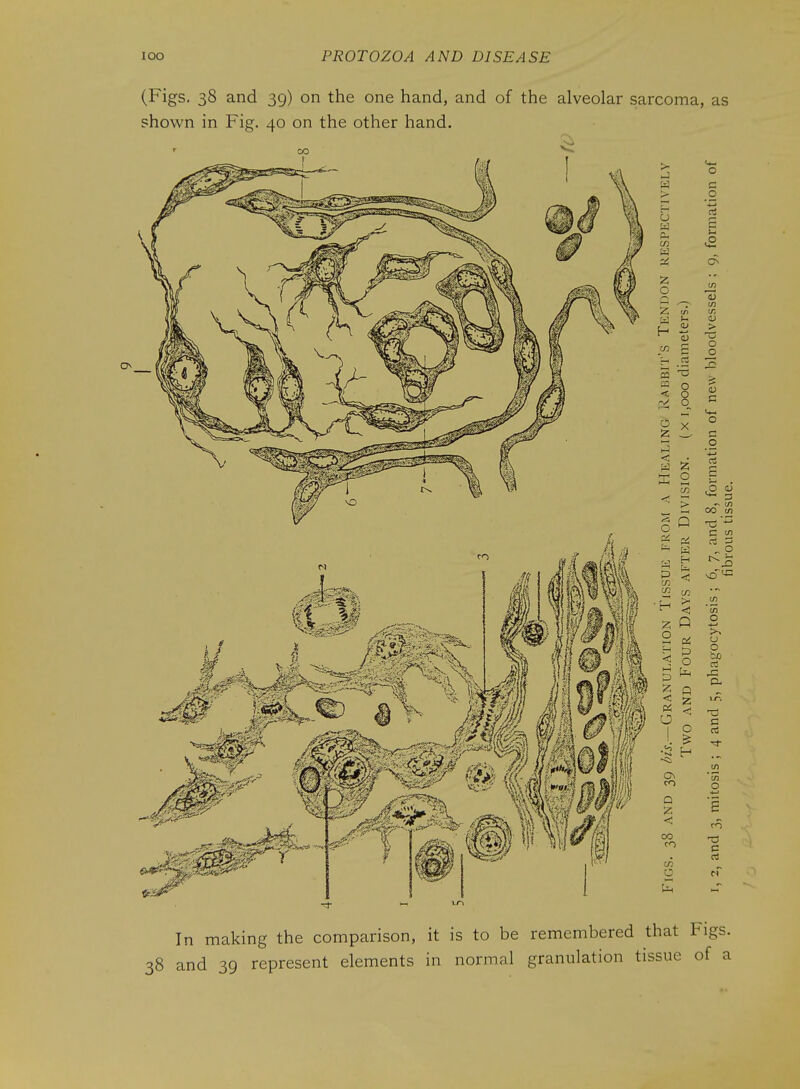 (Figs. 38 and 39) on the one hand, and of the alveolar sarcoma, as shown in Fig. 40 on the other hand. o 1/1 V, > o o <u c o .0 0) „ 1-1 00 J2 C in 1/5 o >^ o o ri D- O c In making the comparison, it is to be remembered that Figs. 38 and 39 represent elements in normal granulation tissue of a