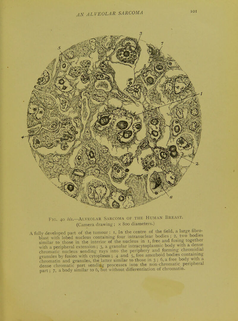 lOI Fig. 40 foj.—Alveolar Sarcoma of the Human Breast. (Camera drawing; x 800 diameters.) A fully developed part of the tumour : i. In the centre of the field, a large fibro- blast with lobed nucleus containing four intranuclear bodies ; 2, two boaies similar to those in the interior of the nucleus in i, free and fusing togetliei with a peripheral extension; 3, a granular intracytoplasmic body with a dense chromatic nucleus sending rays into the periphery and forming chromidial granules by fusion with cytoplasm ; 4 and 5, free amreboid bodies containing chromatin and granules, the latter similar to those m 3 ; 6, a free body with a dense chromatic part sending processes into the non-chromalic peripheial part; 7, a body similar to 6, but without differentiation of chromatin.