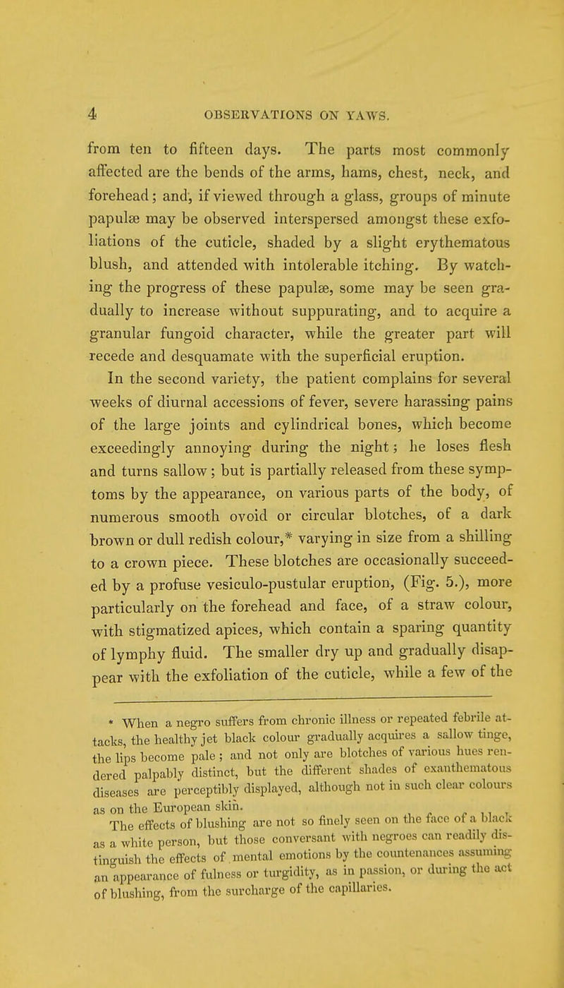 from ten to fifteen days. The parts most commonly affected are the bends of the arms, hams, chest, neck, and forehead; and, if viewed through a glass, groups of minute papulae may be observed interspersed amongst these exfo- liations of the cuticle, shaded by a slight erythematous blush, and attended with intolerable itching. By watch- ing the progress of these papulae, some may be seen gra- dually to increase without suppurating, and to acquire a granular fungoid character, while the greater part will recede and desquamate with the superficial eruption. In the second variety, the patient complains for several weeks of diurnal accessions of fever, severe harassing pains of the large joints and cylindrical bones, which become exceedingly annoying during the night; he loses flesh and turns sallow; but is partially released from these symp- toms by the appearance, on various parts of the body, of numerous smooth ovoid or circular blotches, of a dark brown or dull redish colour,* varying in size from a shilling to a crown piece. These blotches are occasionally succeed- ed by a profuse vesiculo-pustular eruption, (Fig. 5.), more particularly on the forehead and face, of a straw colour, with stigmatized apices, which contain a sparing quantity of lymphy fluid. The smaller dry up and gradually disap- pear with the exfoliation of the cuticle, while a few of the * When a negro suffers from chronic illness or repeated febrile at- tacks, the healthy jet black colour gradually acquires a sallow tinge, the li'ps become pale ; and not only are blotches of various hues ren dered palpably distinct, but the different shades of exanthematous diseases are perceptibly displayed, although not in such clear colours as on the European skin. The effects of blushing are not so finely seen on the face of a blacft as a white person, but those conversant with negroes can readily dis- tinguish the effects of mental emotions by the countenances assuming an appearance of fulness or turgidity, as in passion, or during the act of blushing, from the surcharge of the capillaries.