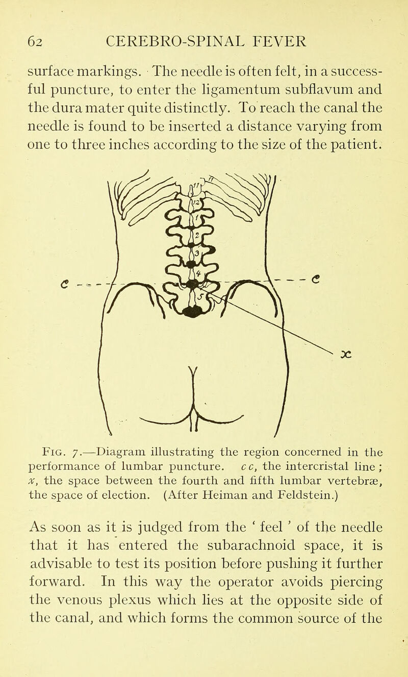 surface markings. The needle is often felt, in a success- ful puncture, to enter the ligamentum subflavum and the dura mater quite distinctly. To reach the canal the needle is found to be inserted a distance varying from one to three inches according to the size of the patient. Fig. 7.—Diagram illustrating the region concerned in the performance of lumbar puncture. cc, the intercristal line ; X, the space between the fourth and fifth lumbar vertebras, the space of election. (After Heiman and Feldstein.) As soon as it is judged from the ' feel ' of the needle that it has entered the subarachnoid space, it is advisable to test its position before pushing it further forward. In this way the operator avoids piercing the venous plexus which lies at the opposite side of the canal, and which forms the common source of the