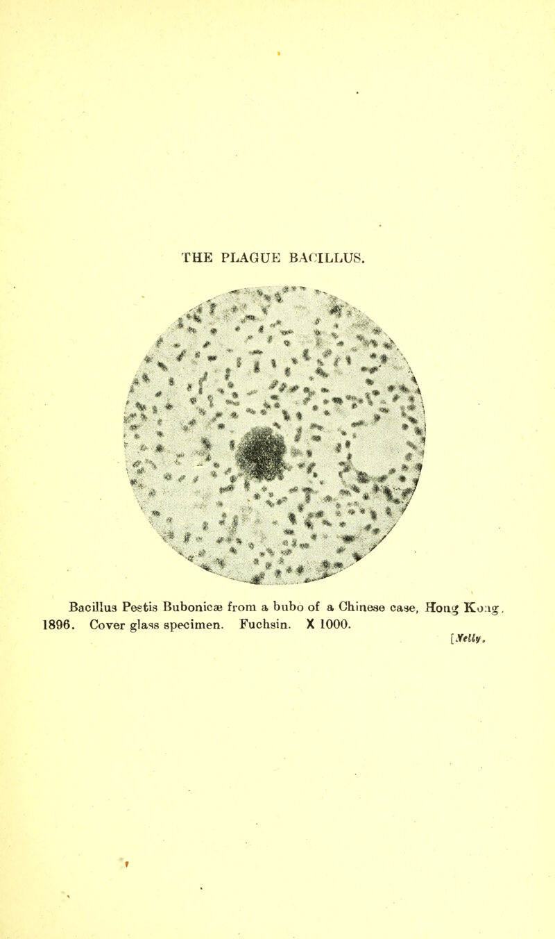 THE PLAGUE BACILLUS. A * I * f % - ;- .♦V A, »/.*-» %* * ' * •* *4 #1 V • f # * % 4« Bacillus Pestis Bubonicae from a bubo of a Chinese case, Hong Kong, 1896. Cover glass specimen. Fuchsin. X 1000. UYeUy. 1